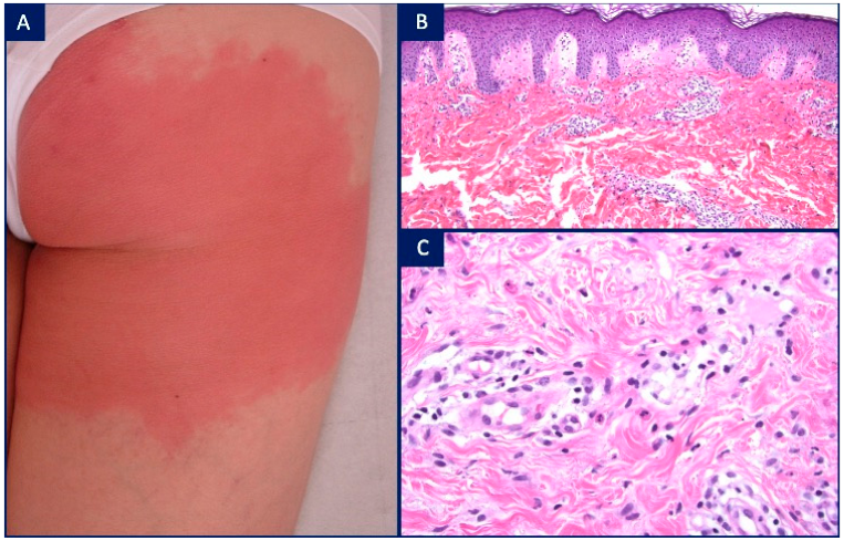 Dermatopathology 08 00026 g004