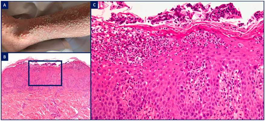 Dermatopathology 08 00026 g005