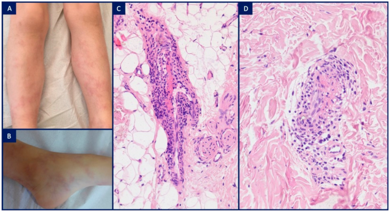Dermatopathology 08 00026 g007