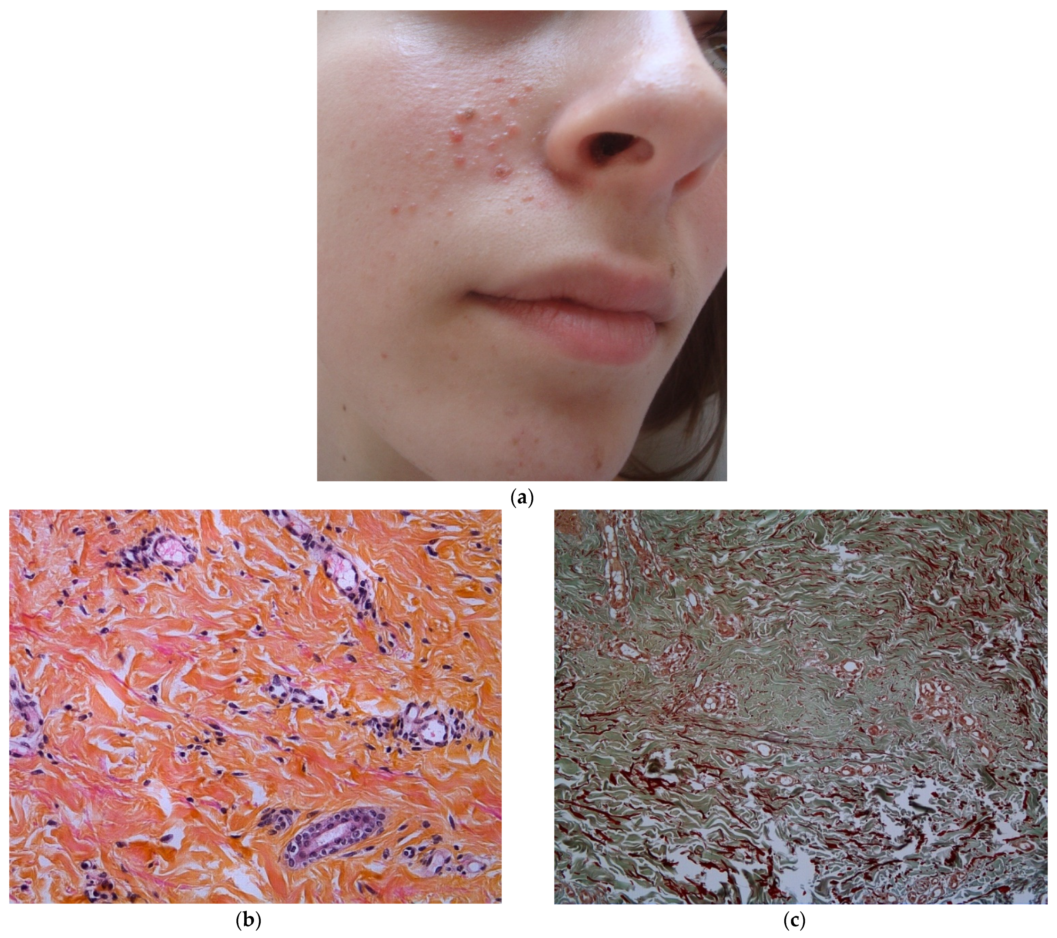 Dermatopathology 08 00029 g002