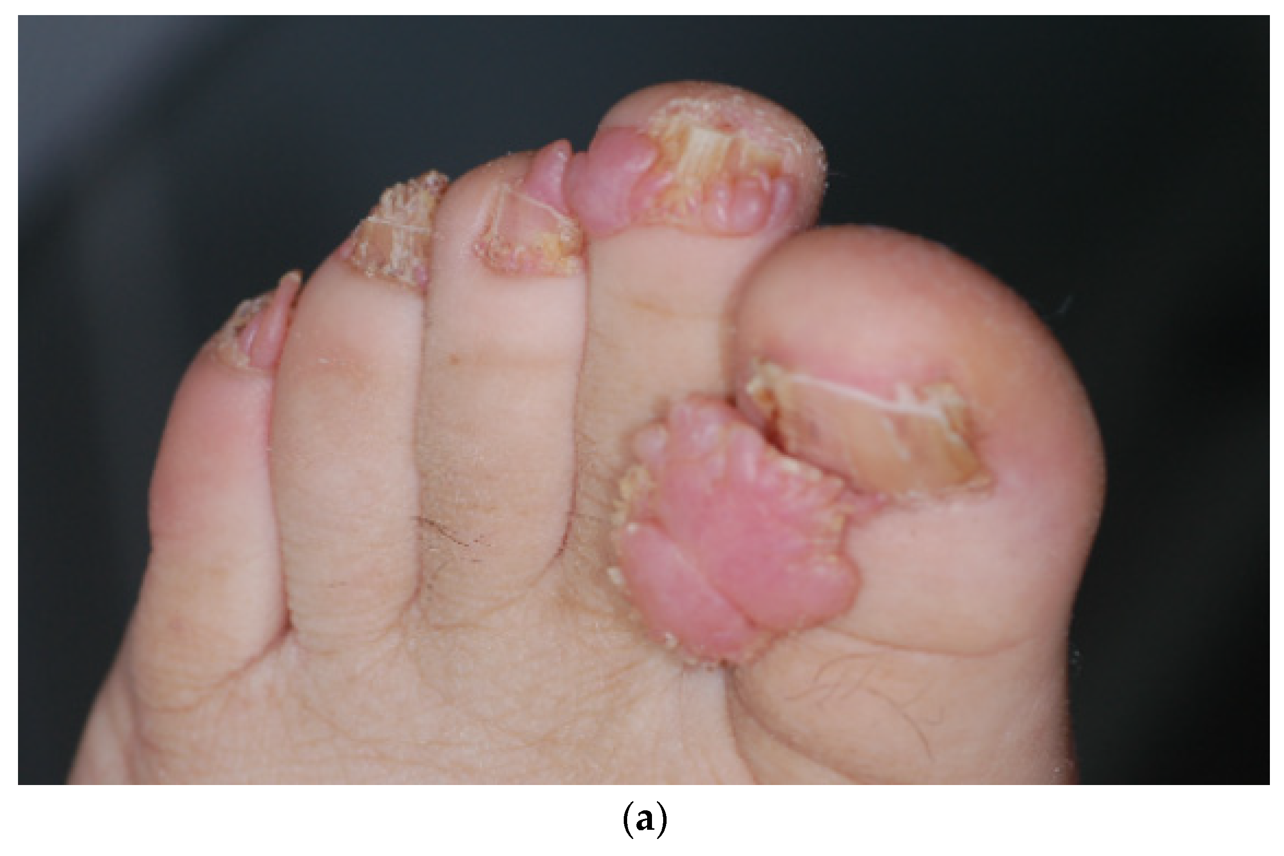 Dermatopathology 08 00029 g003a