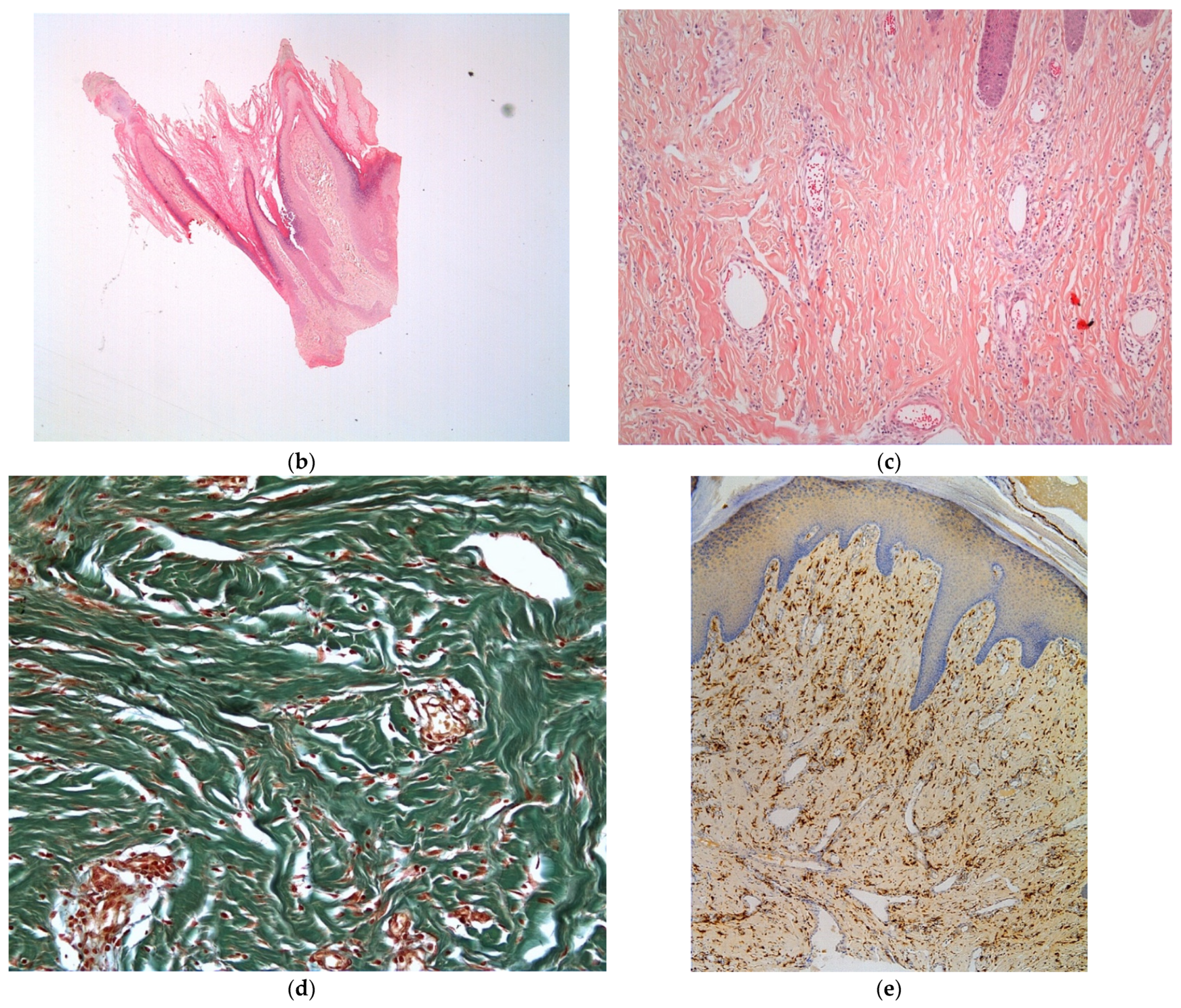 Dermatopathology 08 00029 g003b