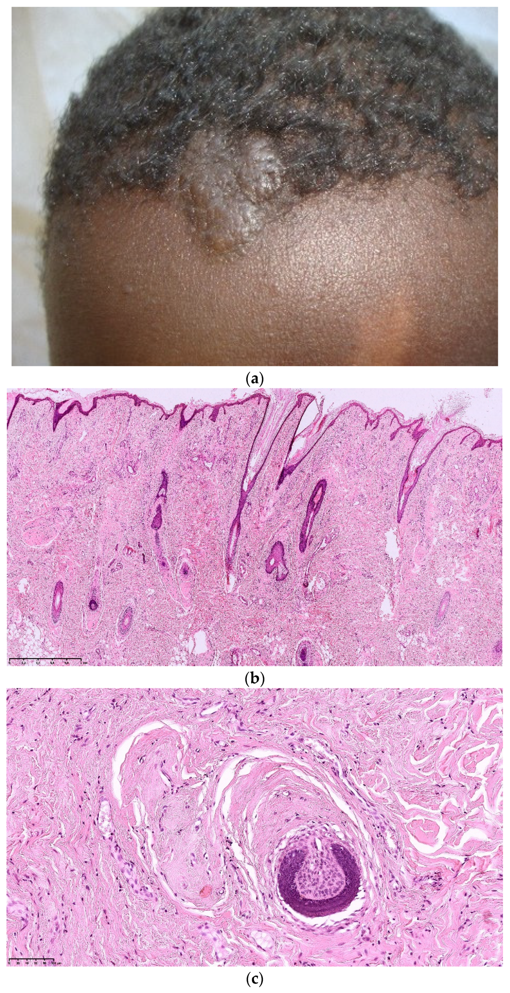 Dermatopathology 08 00029 g004
