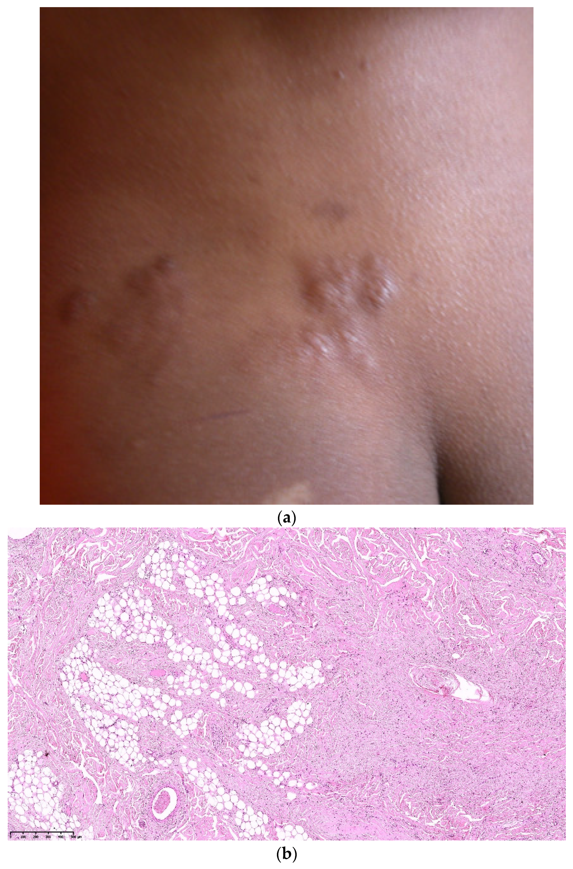 Dermatopathology 08 00029 g005a