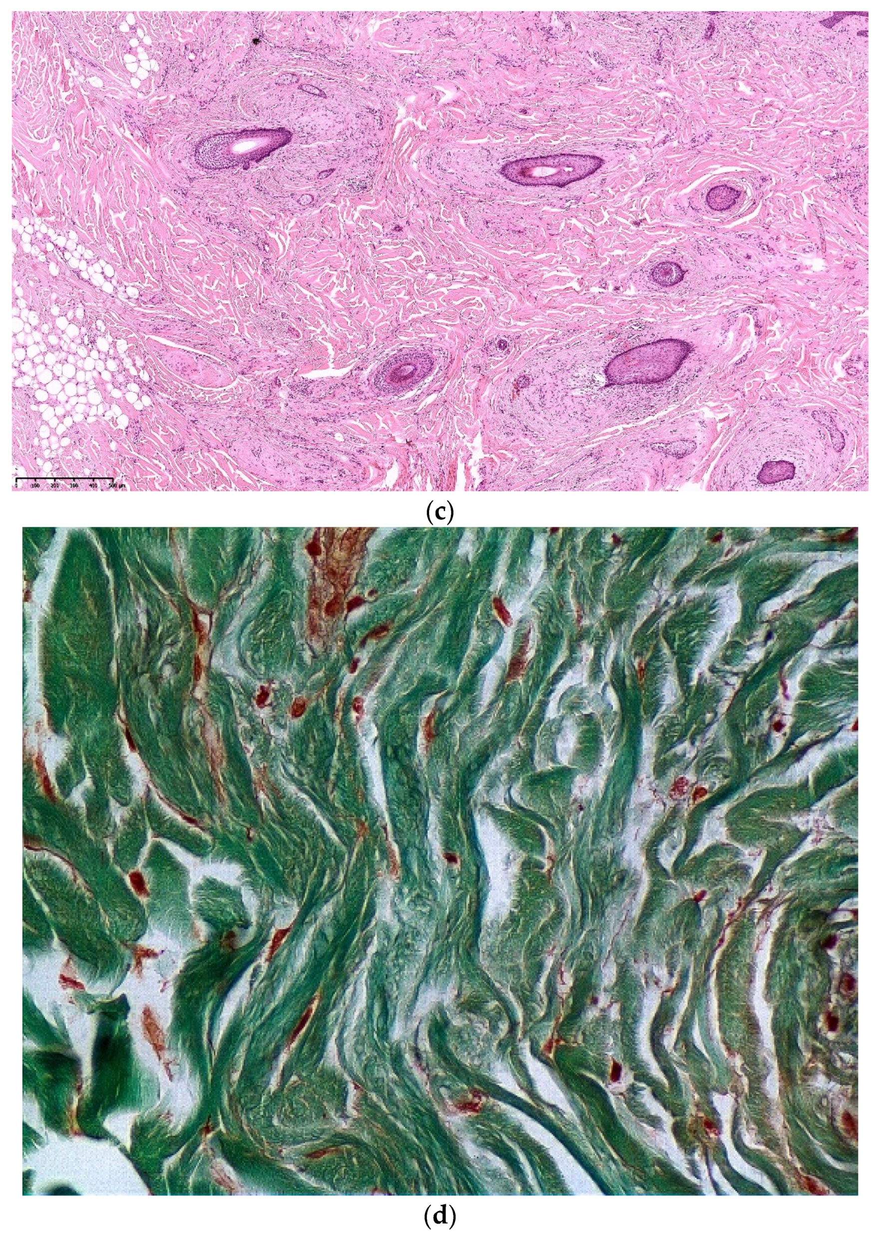 Dermatopathology 08 00029 g005b
