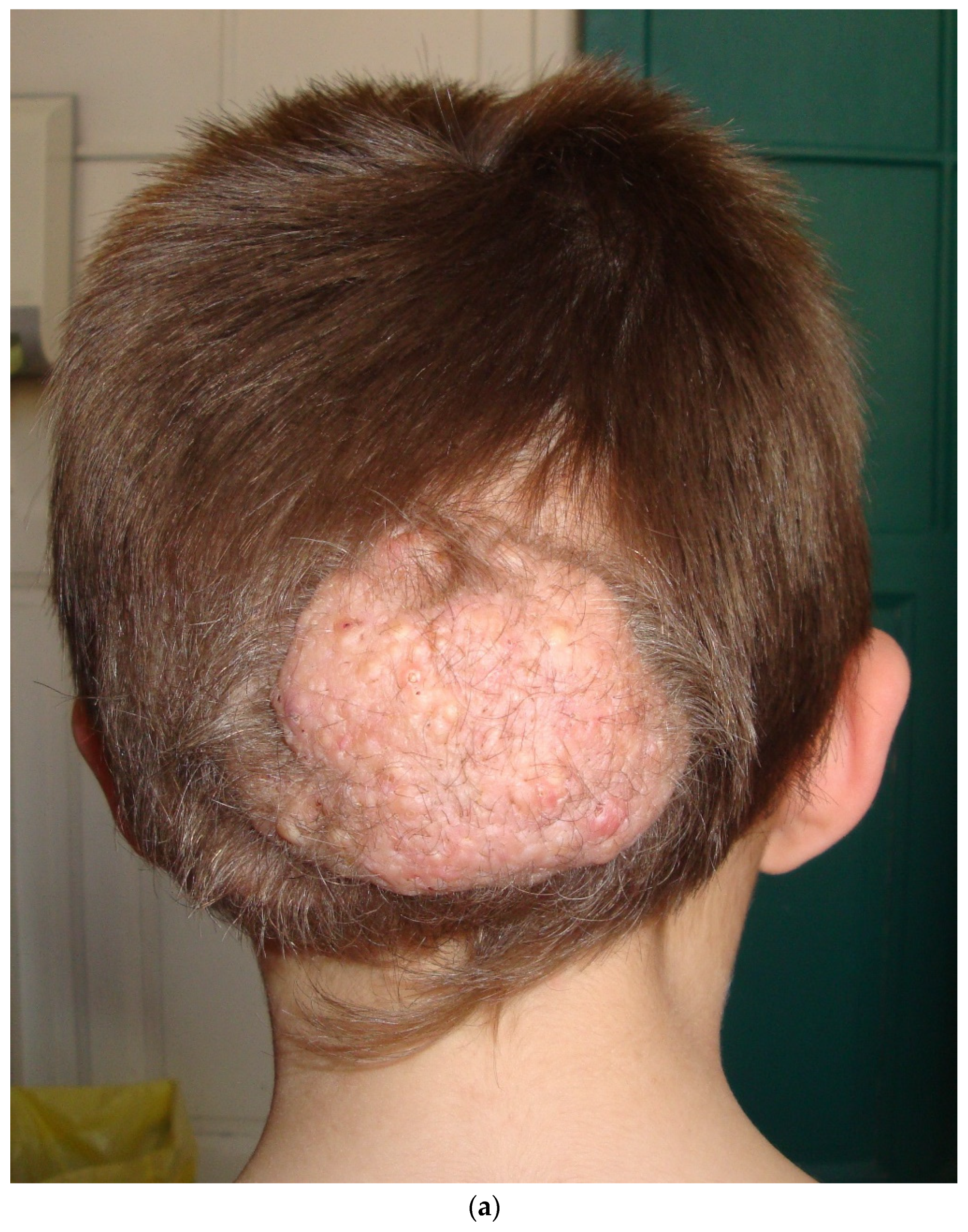 Dermatopathology 08 00029 g006a