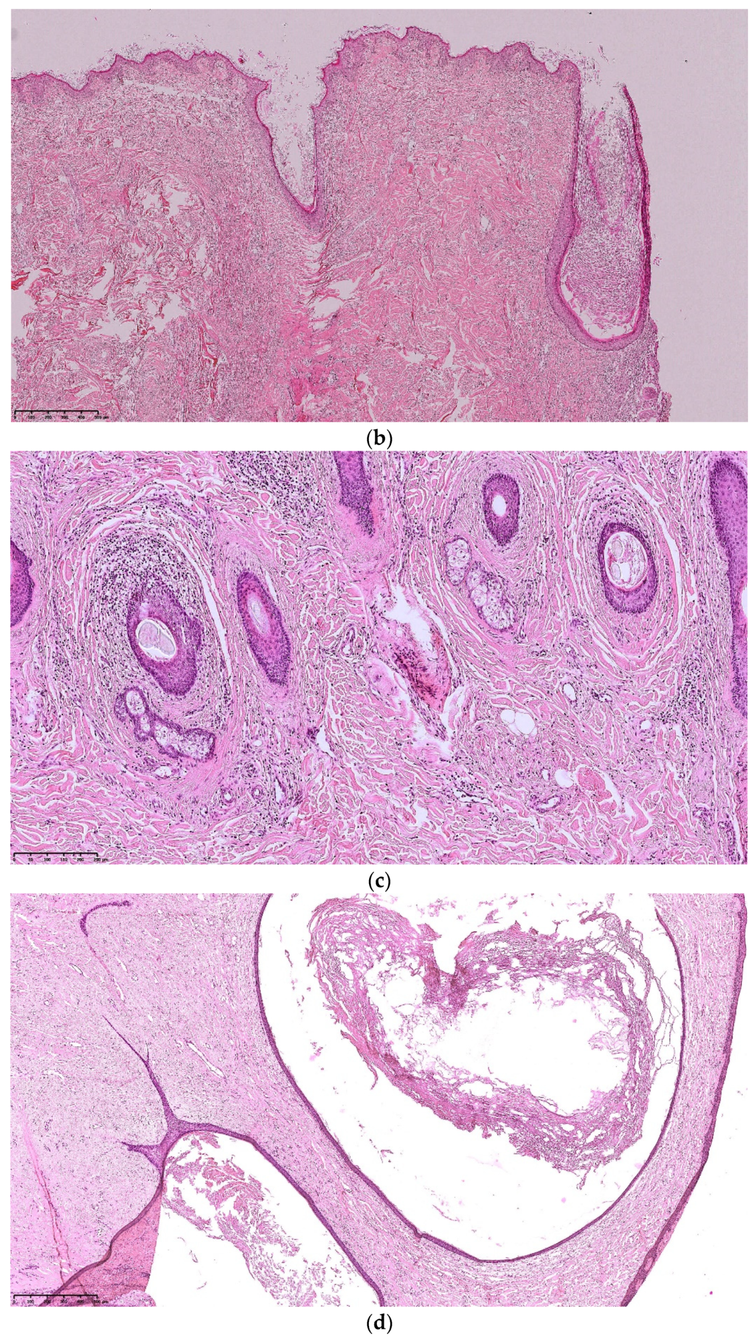 Dermatopathology 08 00029 g006b
