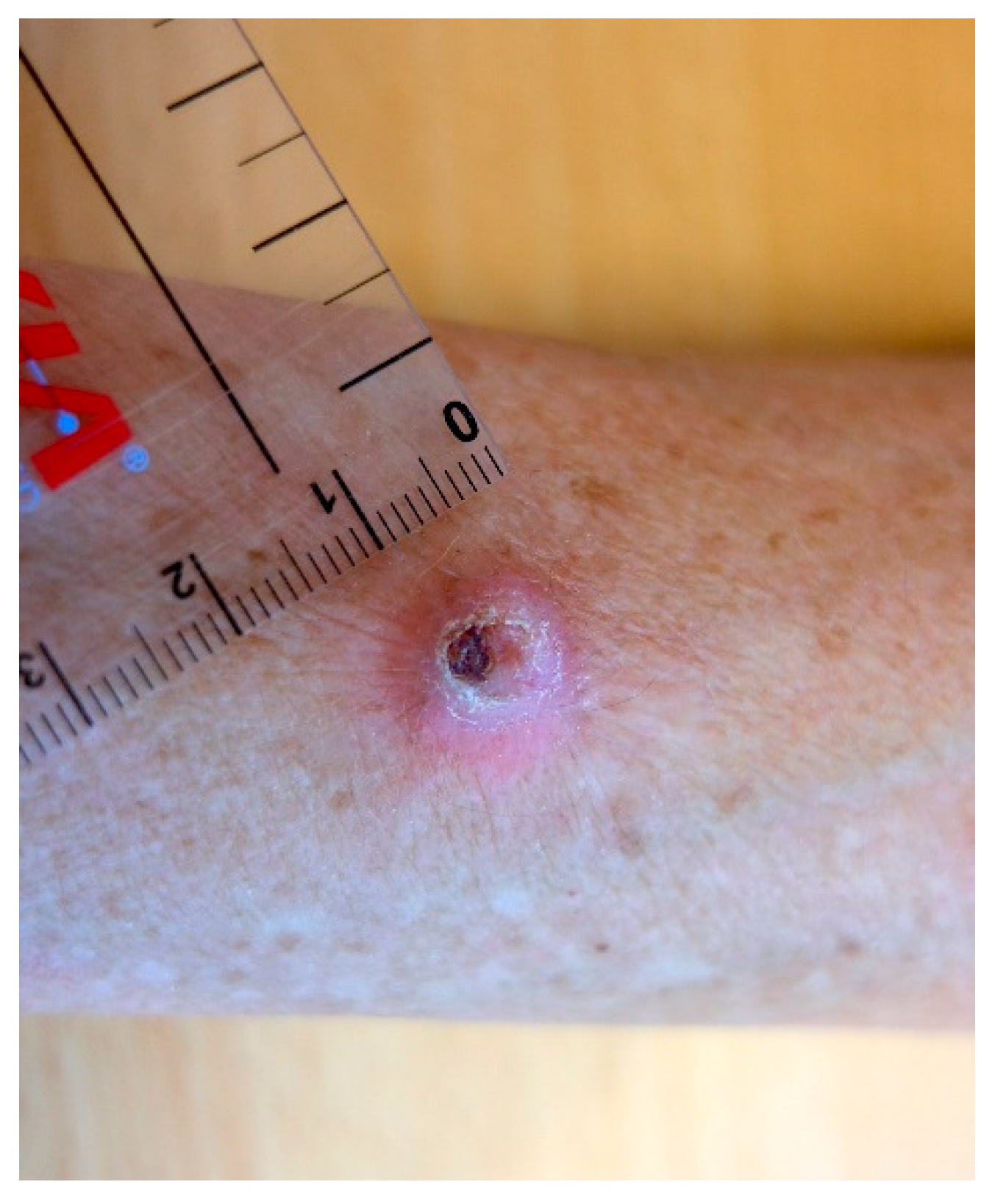 Dermatopathology 08 00030 g001