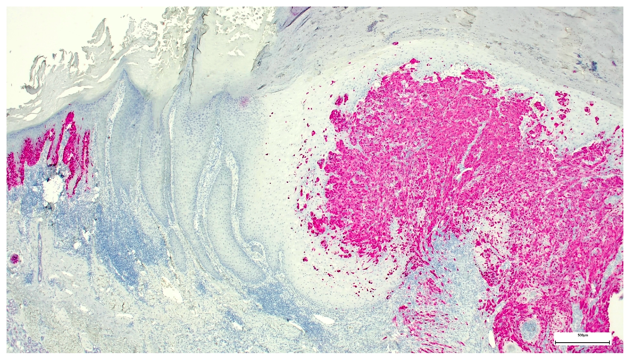 Dermatopathology 08 00030 g005