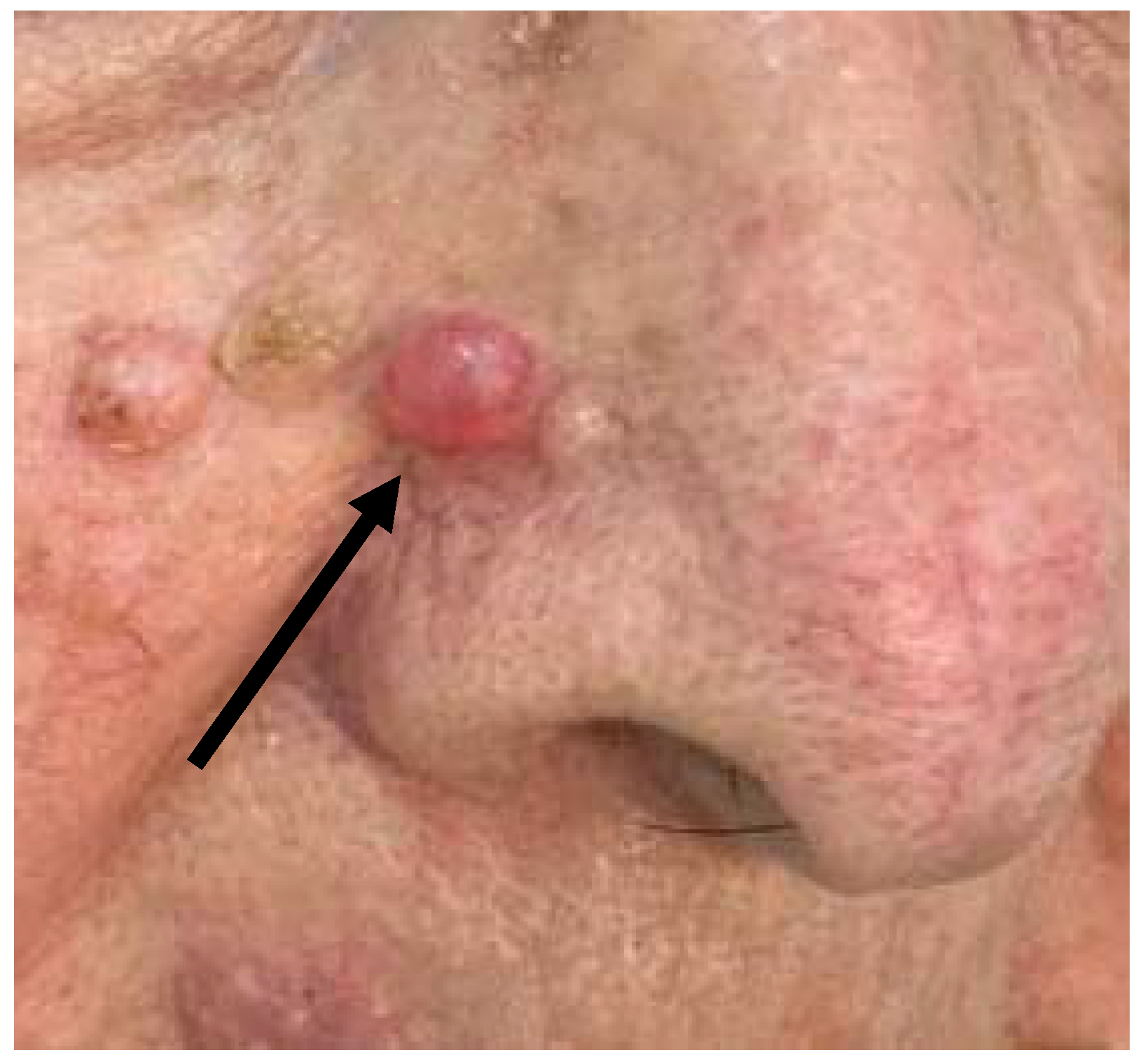 Dermatopathology 08 00032 g001