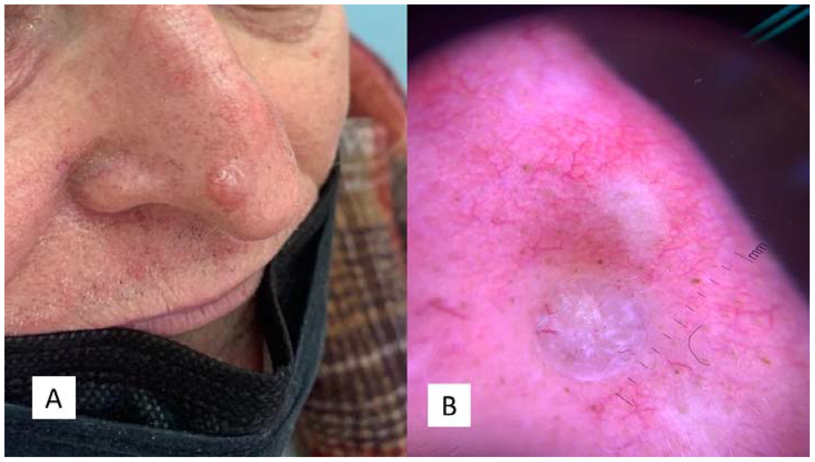 Dermatopathology 08 00032 g002