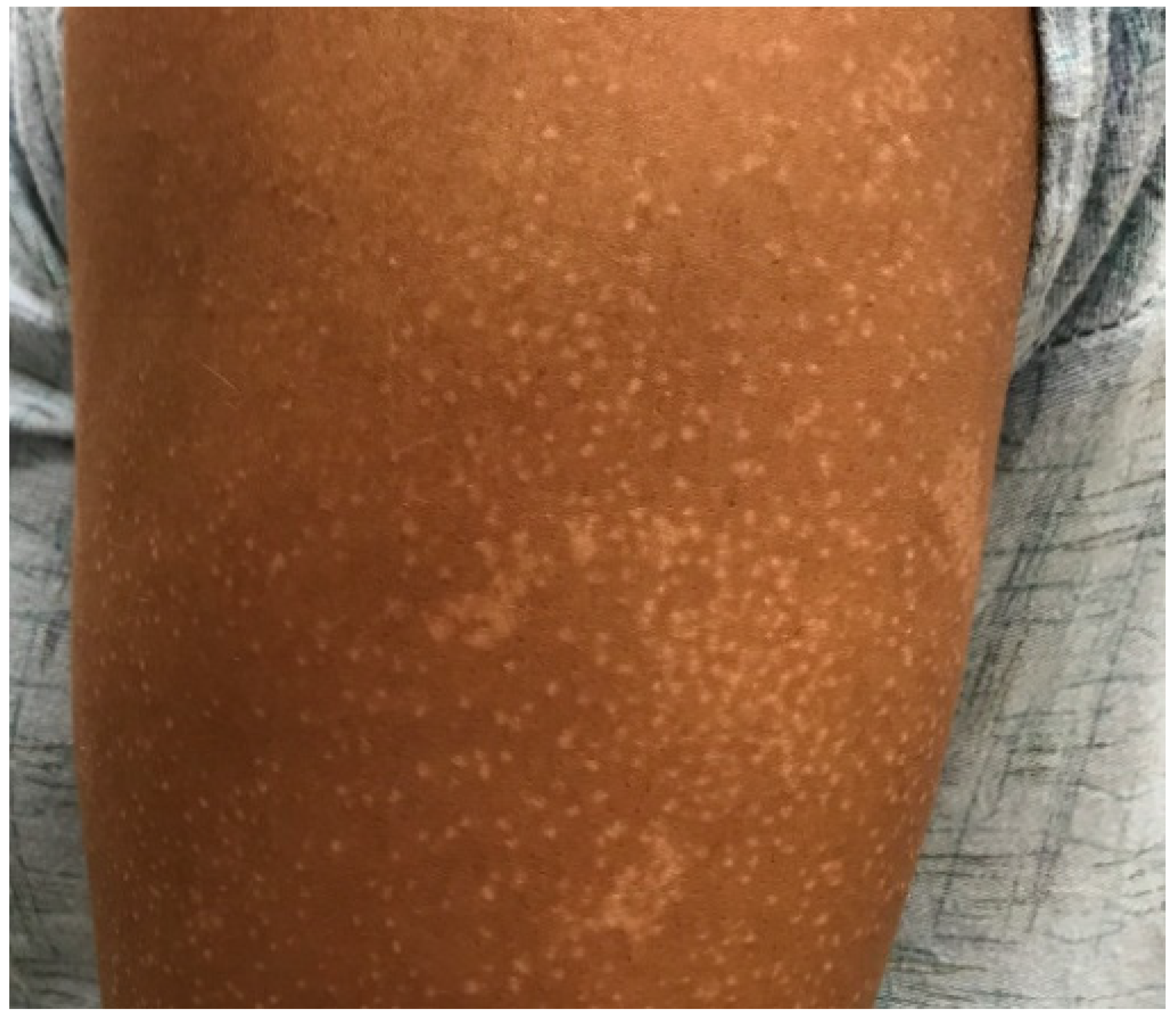 Dermatopathology 08 00034 g002