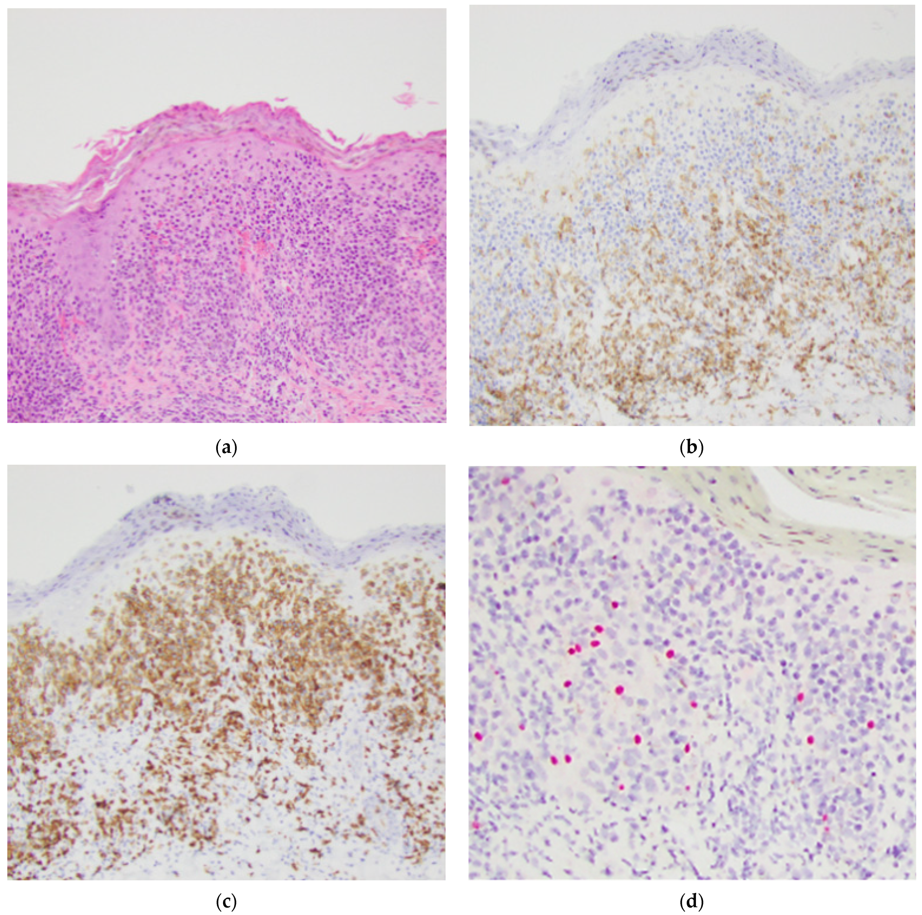 Dermatopathology 08 00034 g004