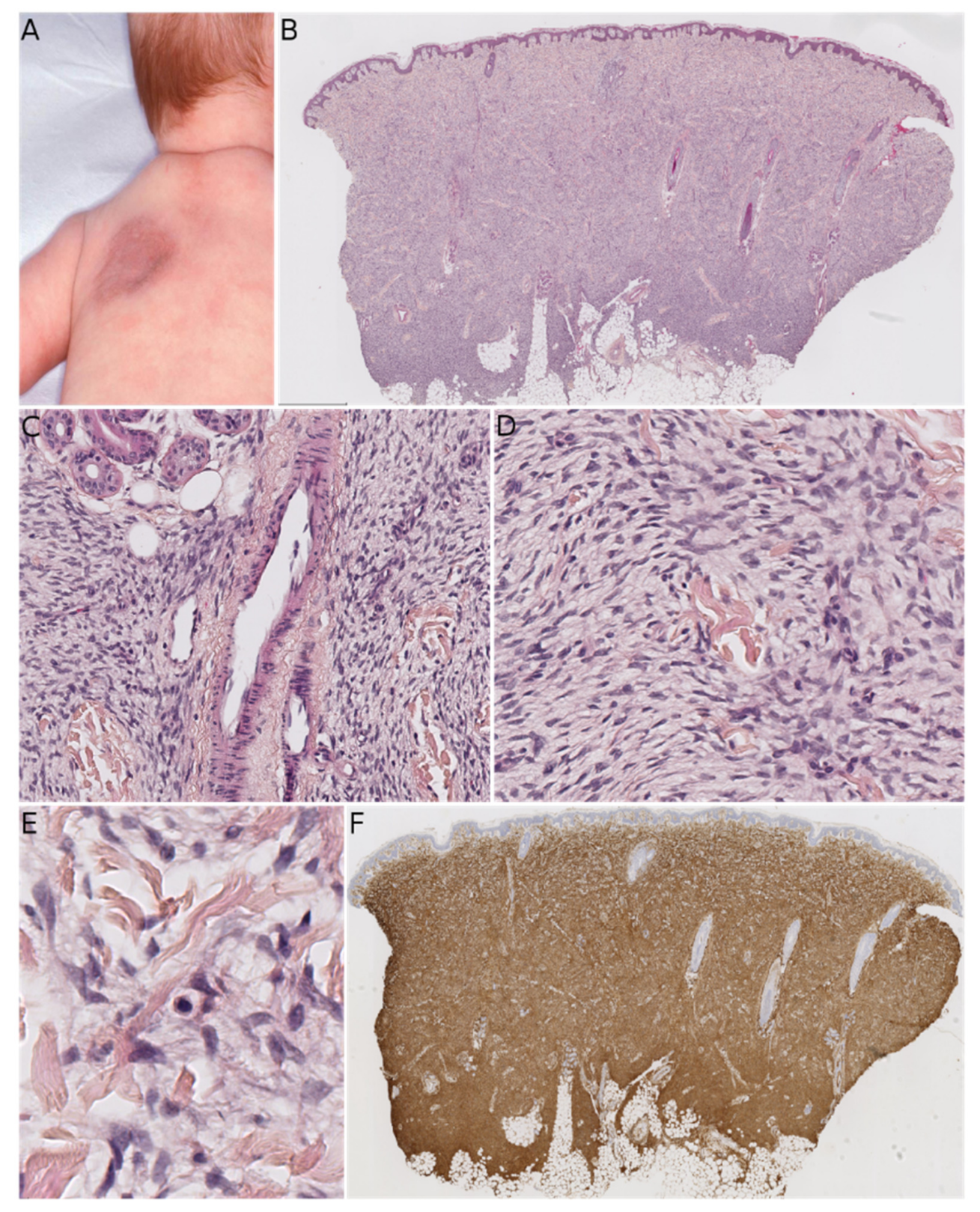 Dermatopathology 08 00035 g002