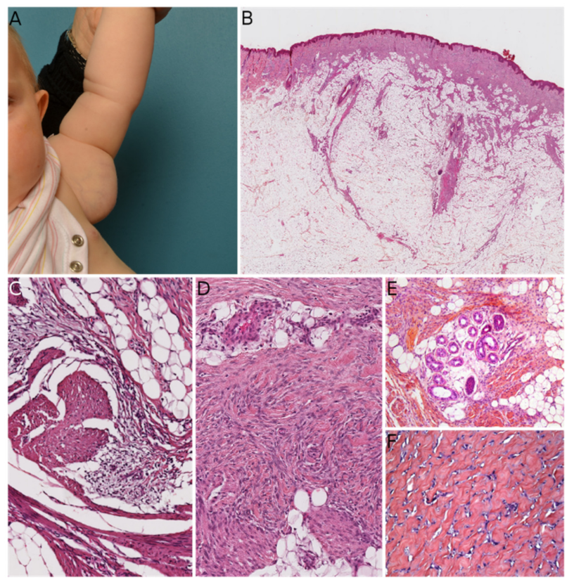 Dermatopathology 08 00035 g003