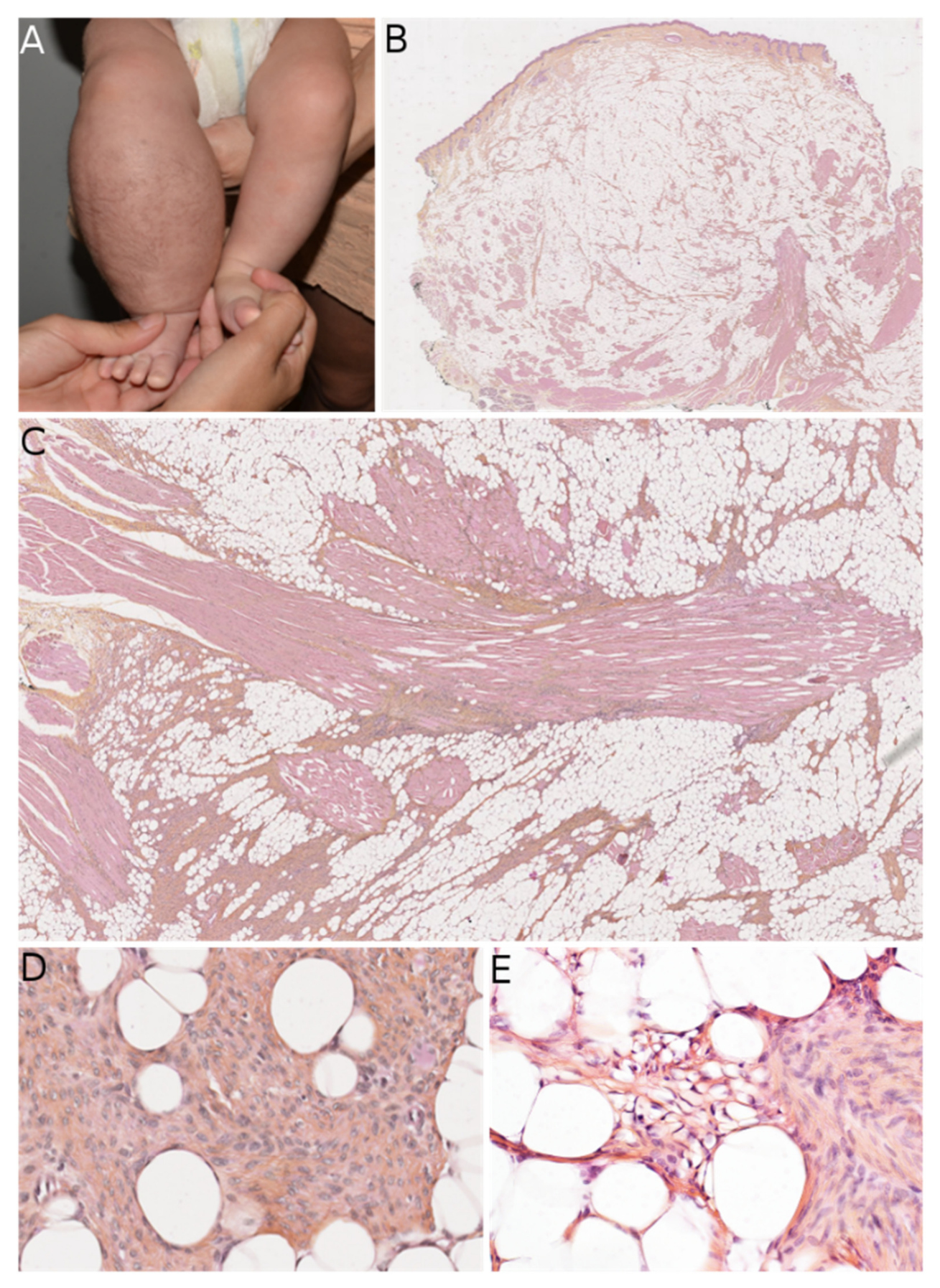 Dermatopathology 08 00035 g004