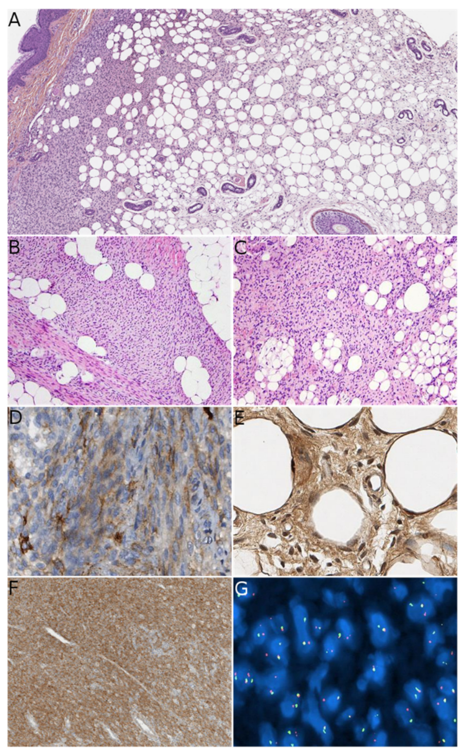 Dermatopathology 08 00035 g005