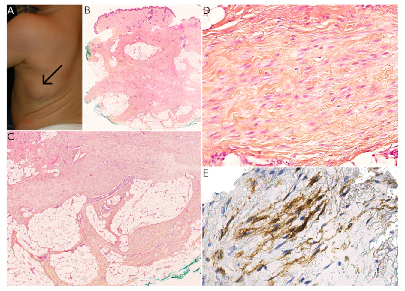 Dermatopathology 08 00035 g006