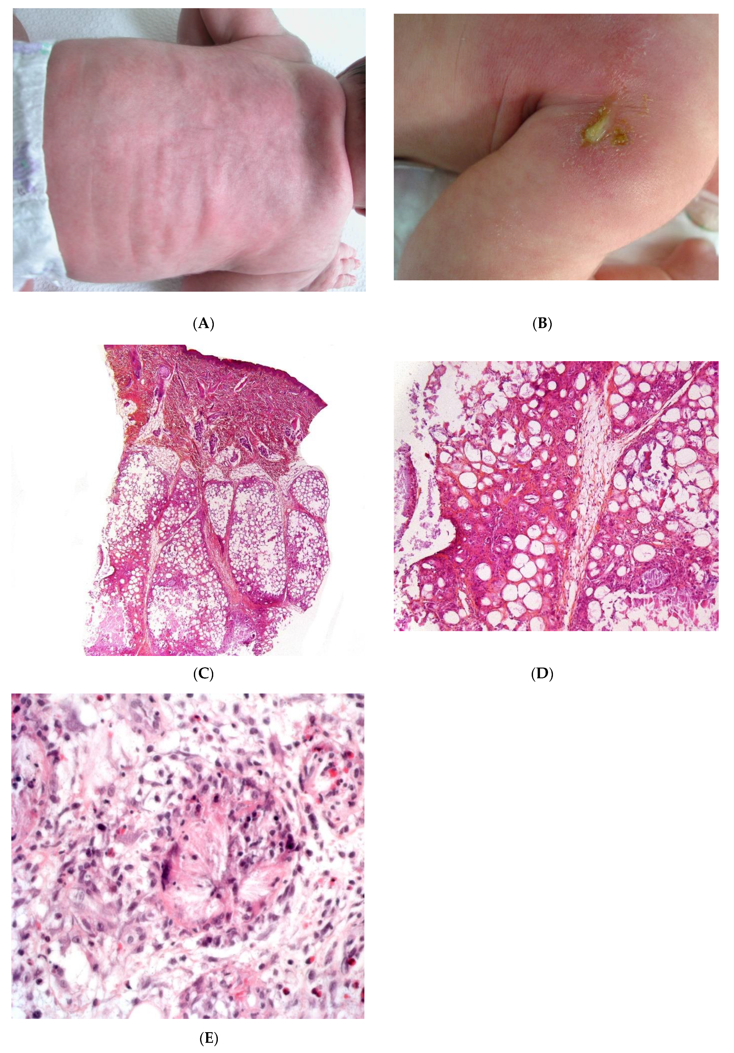 Dermatopathology 08 00037 g001 Dermatopathology 08 00037 g001
