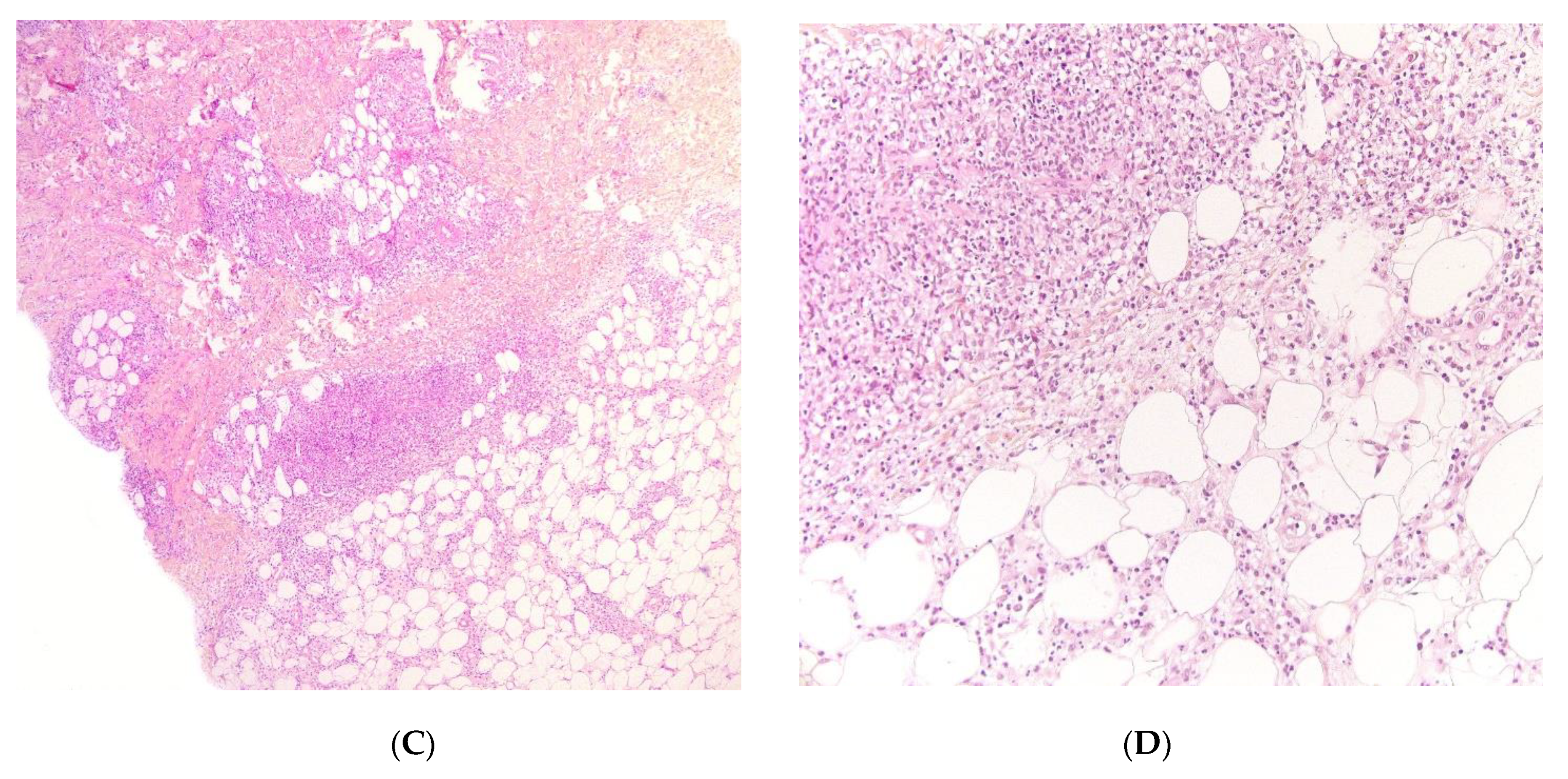 Dermatopathology 08 00037 g003b Dermatopathology 08 00037 g003b