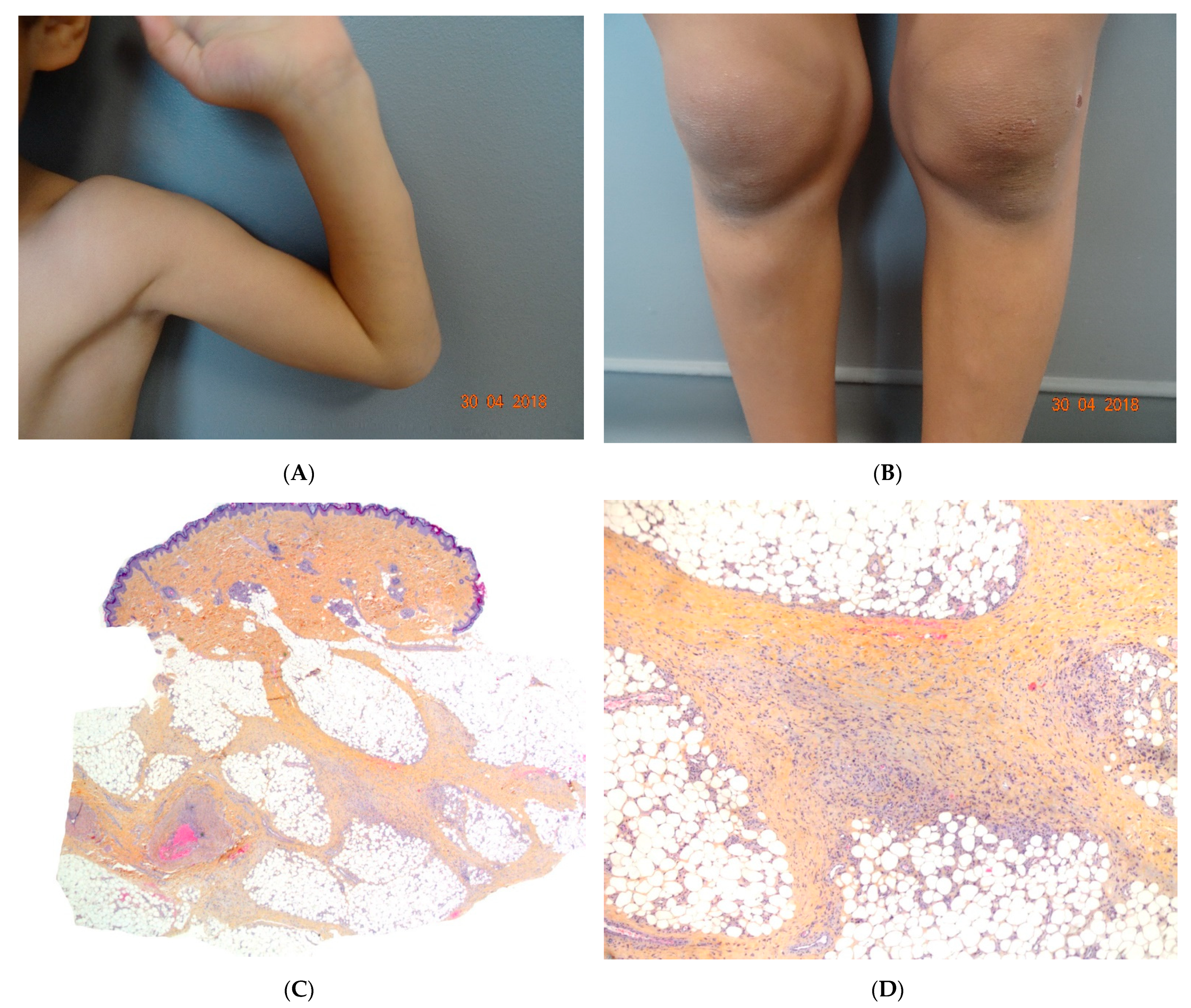 Dermatopathology 08 00037 g006 Dermatopathology 08 00037 g006