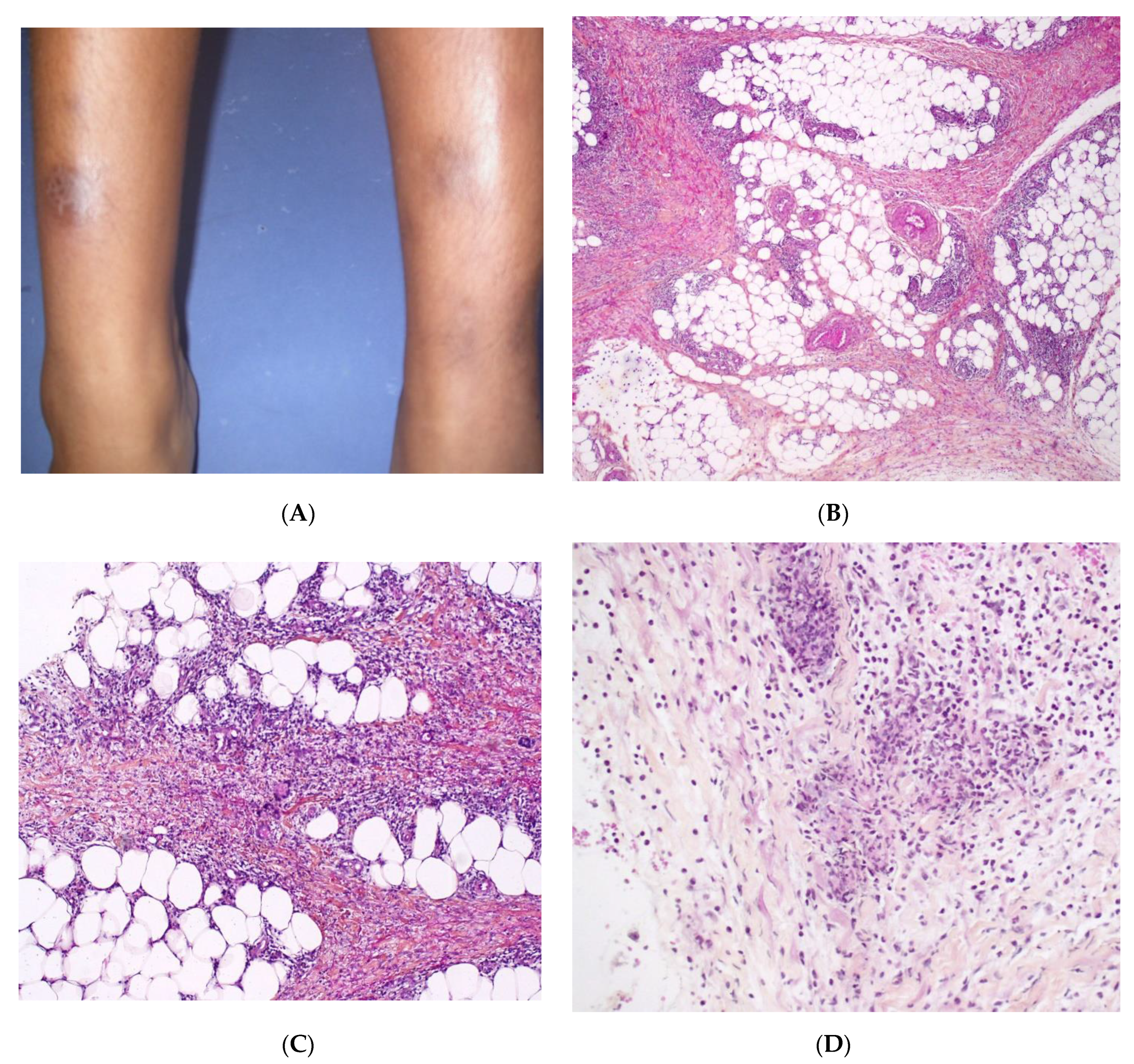 Dermatopathology 08 00037 g007 Dermatopathology 08 00037 g007