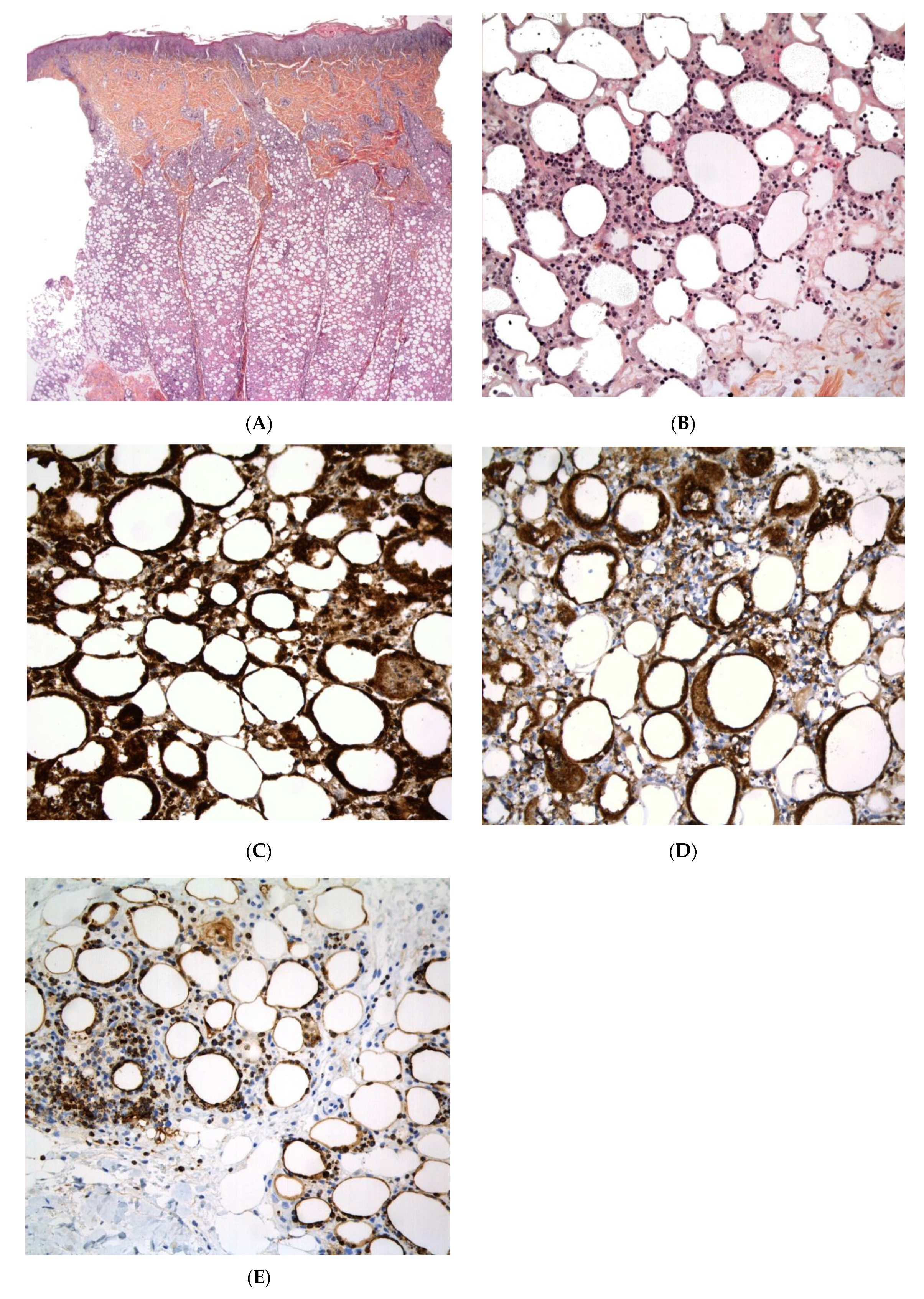 Dermatopathology 08 00037 g010 Dermatopathology 08 00037 g010