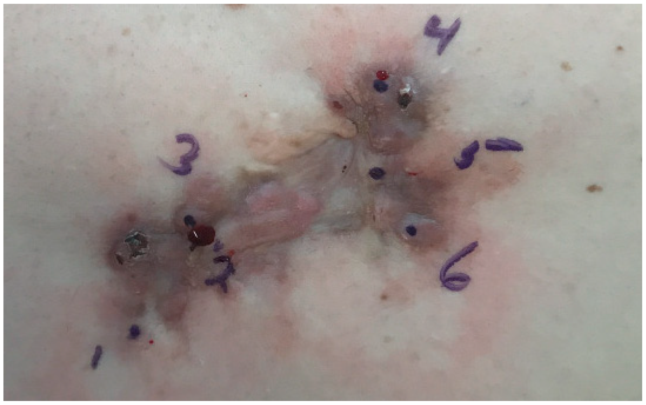 Dermatopathology 08 00038 g001