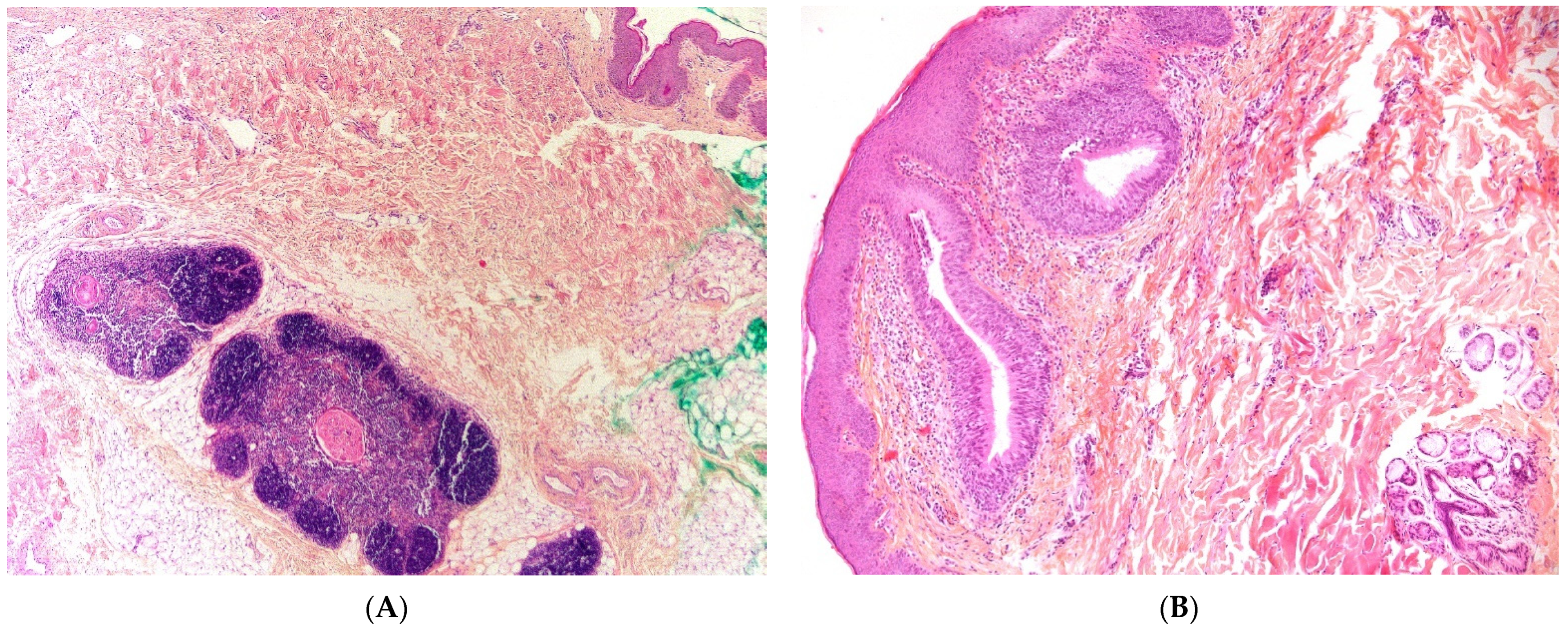 Dermatopathology 08 00039 g006