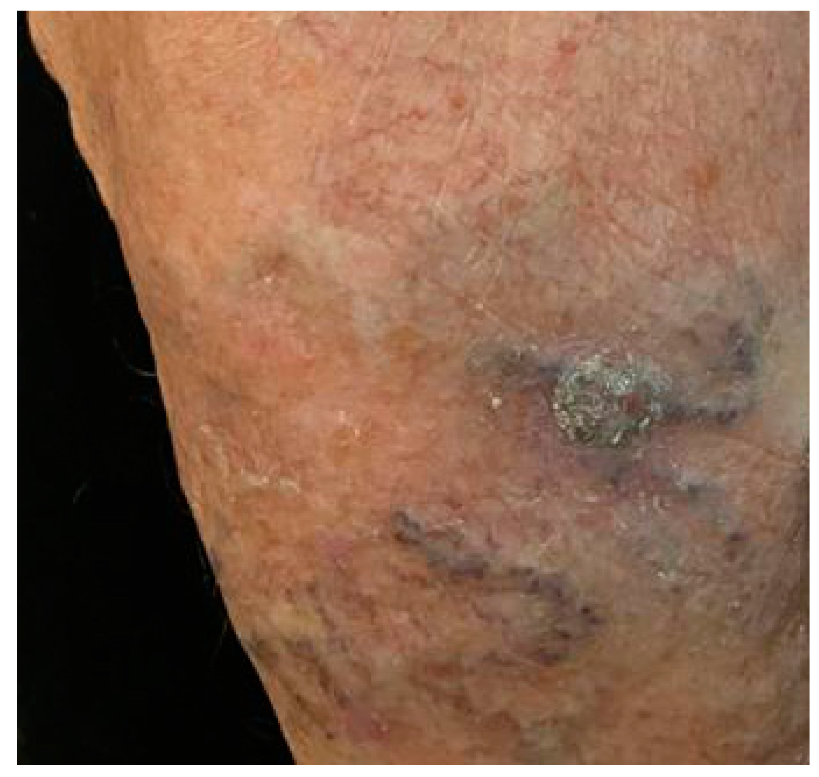 Dermatopathology 08 00041 g001