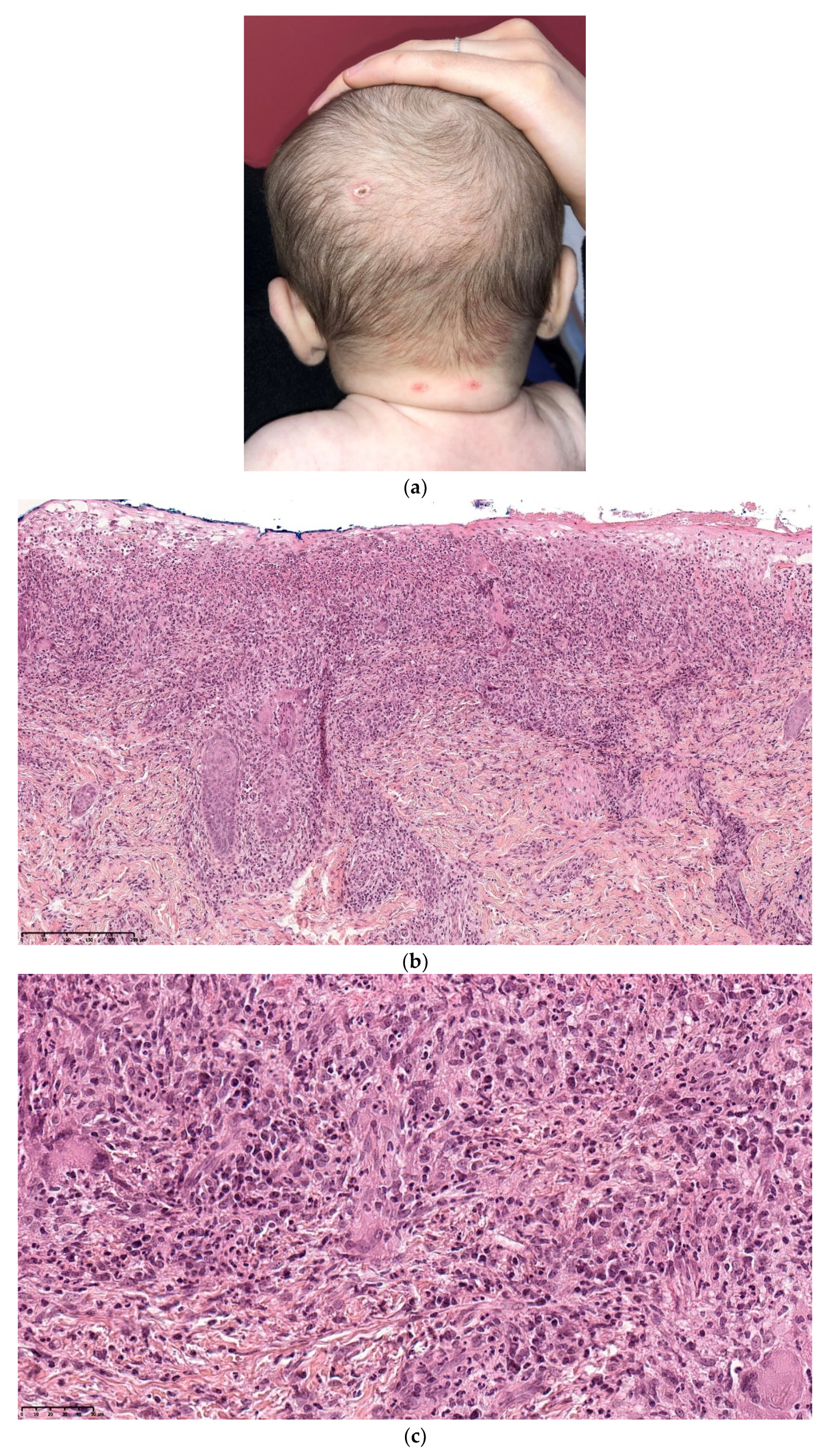 Dermatopathology 08 00043 g002a