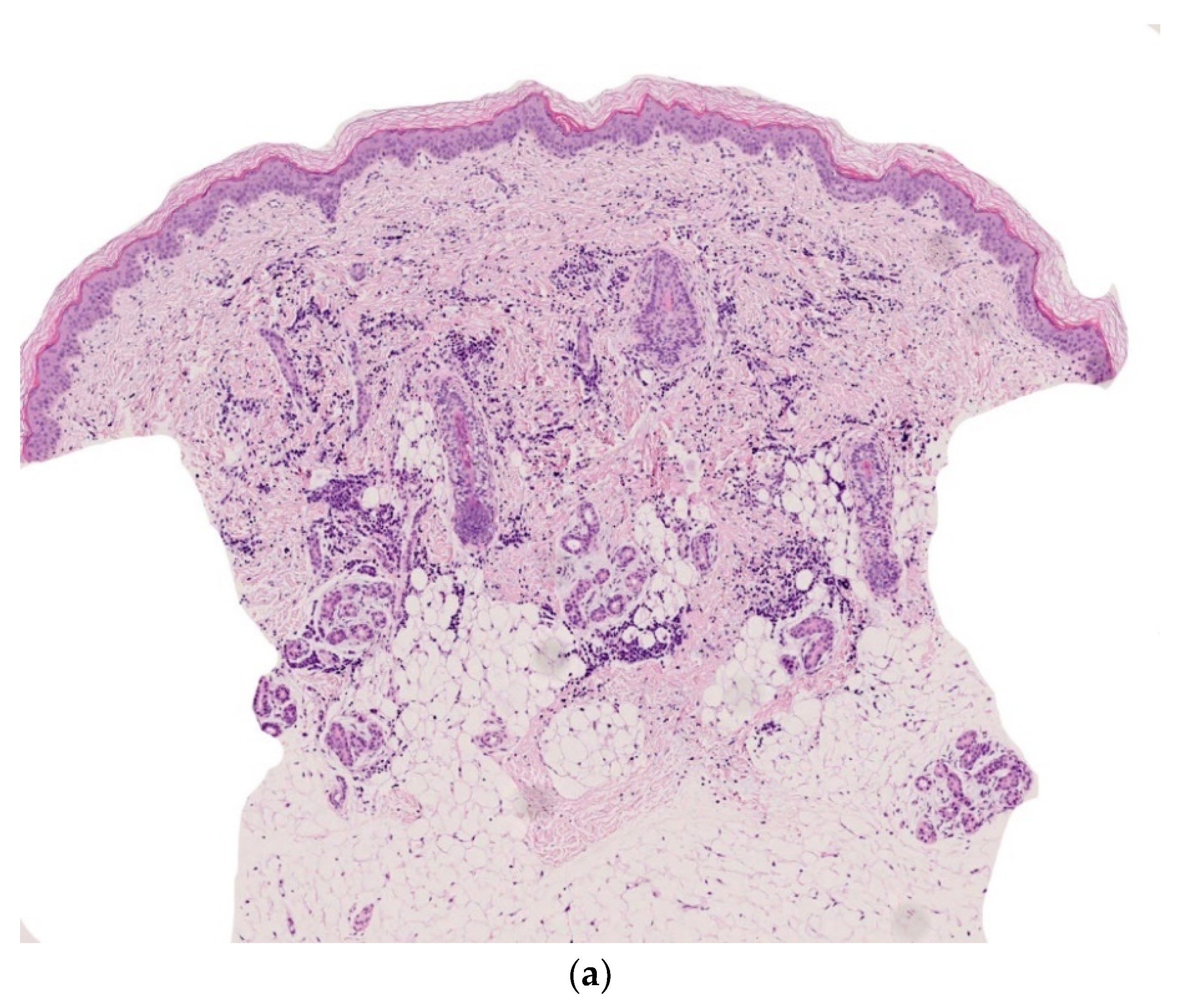 Dermatopathology 08 00043 g003a