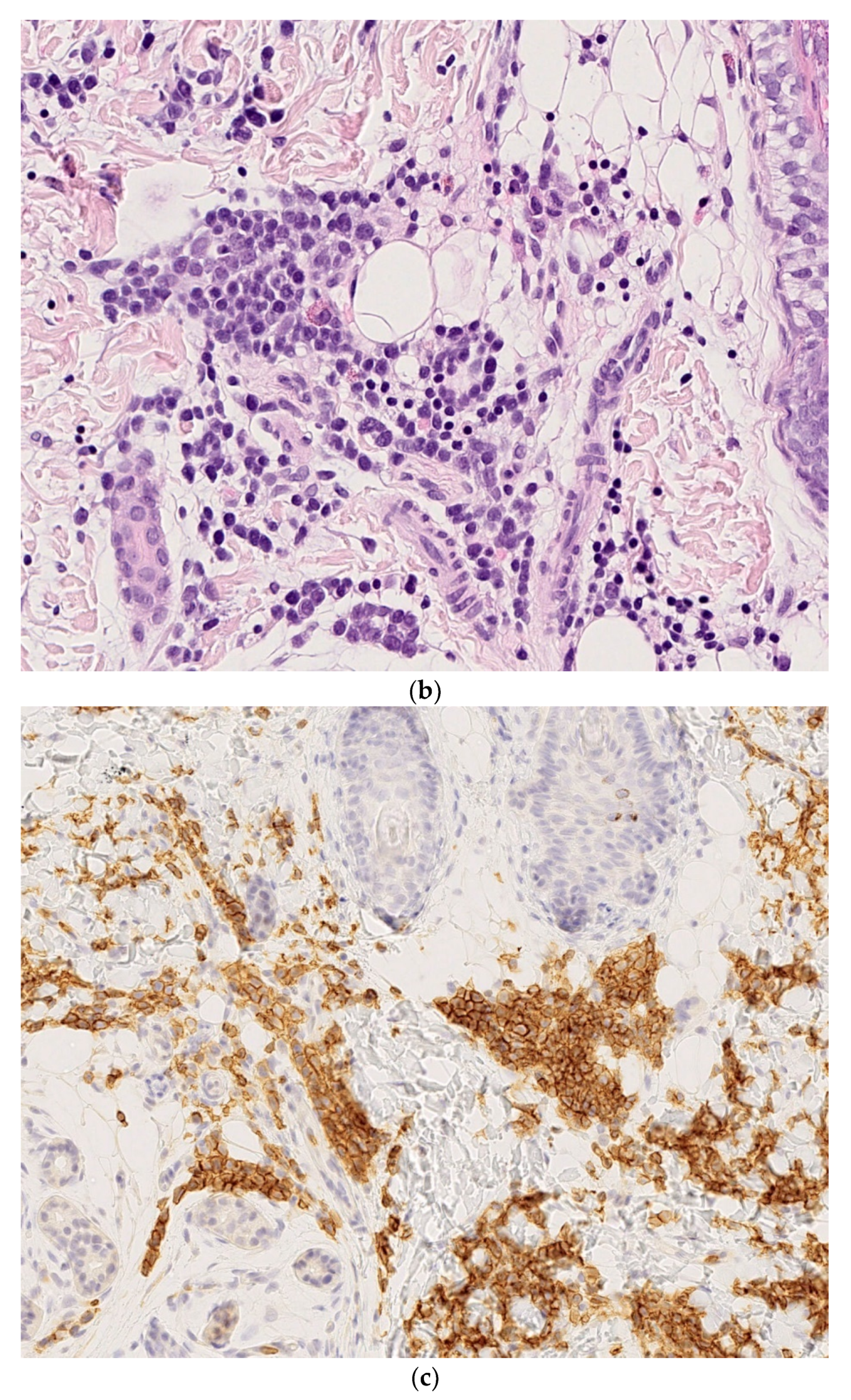 Dermatopathology 08 00043 g003b