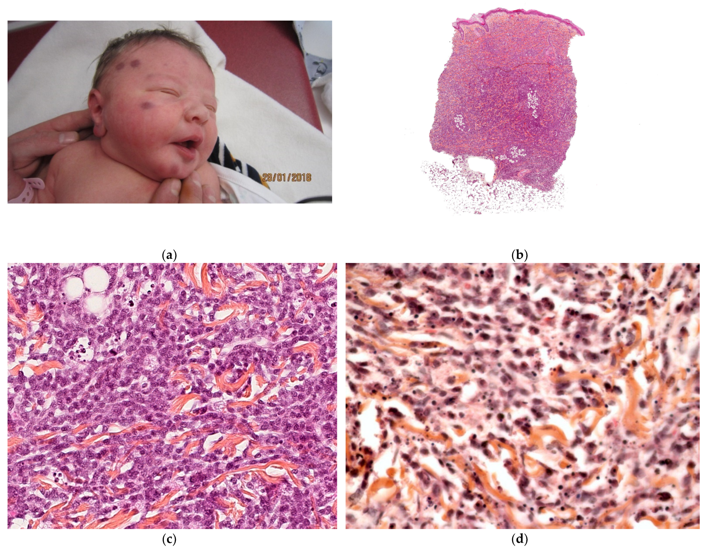 Dermatopathology 08 00043 g004a