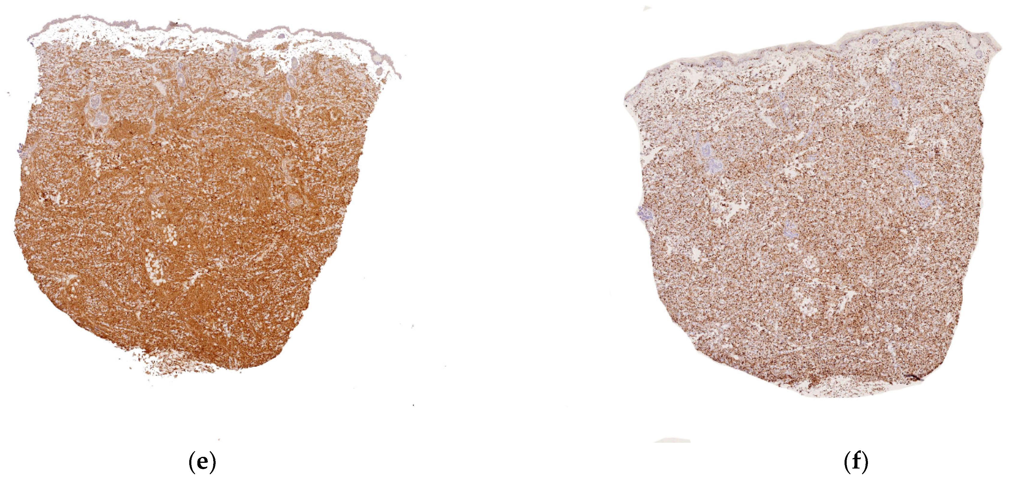 Dermatopathology 08 00043 g004b