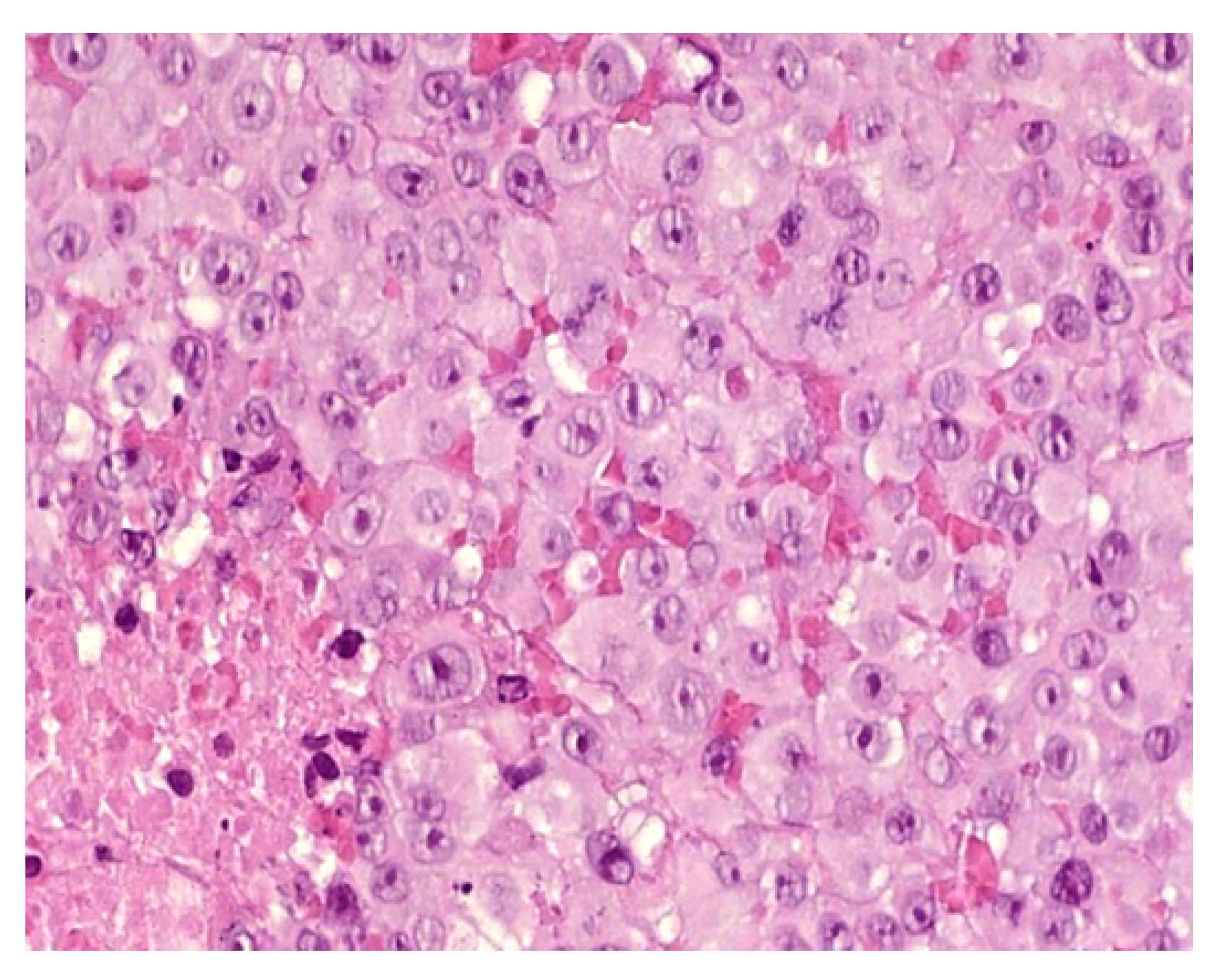 Dermatopathology 08 00043 g006