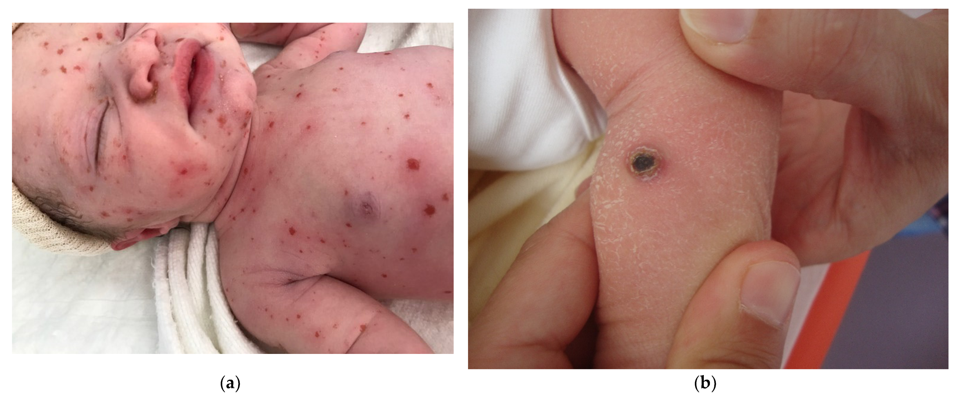 Dermatopathology 08 00043 g007a