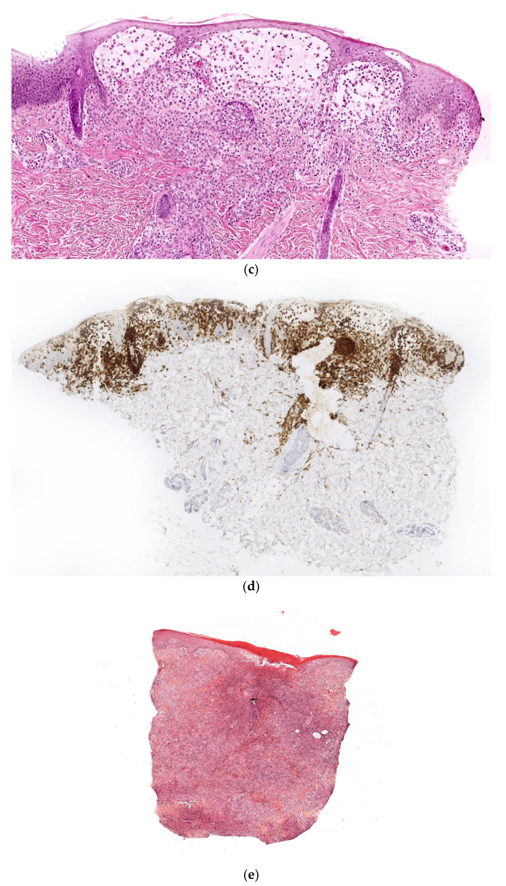 Dermatopathology 08 00043 g007b