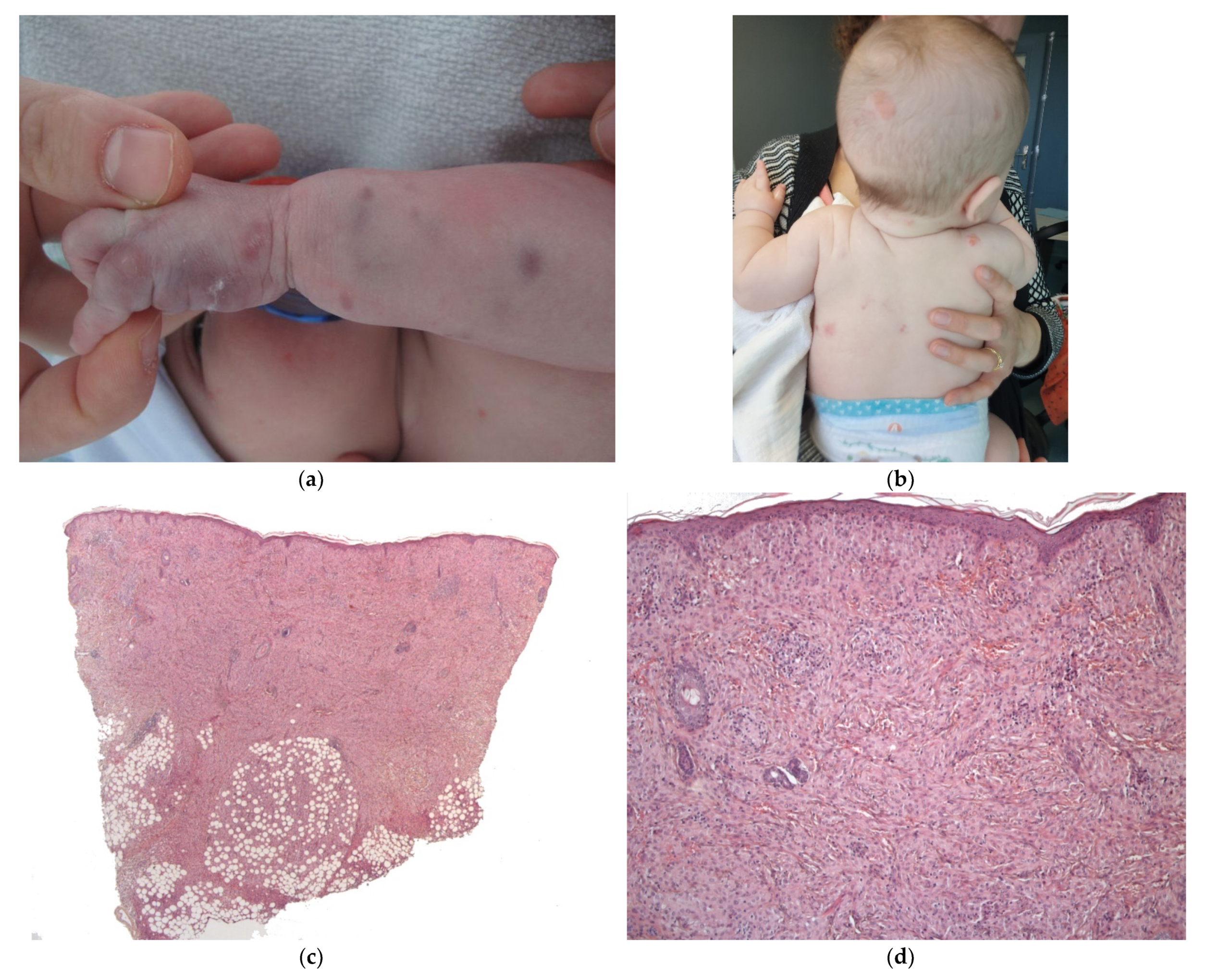 Dermatopathology 08 00043 g008a
