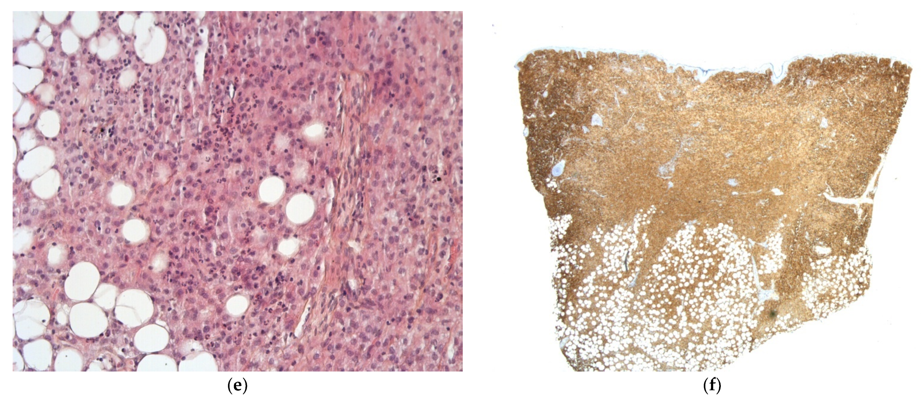 Dermatopathology 08 00043 g008b