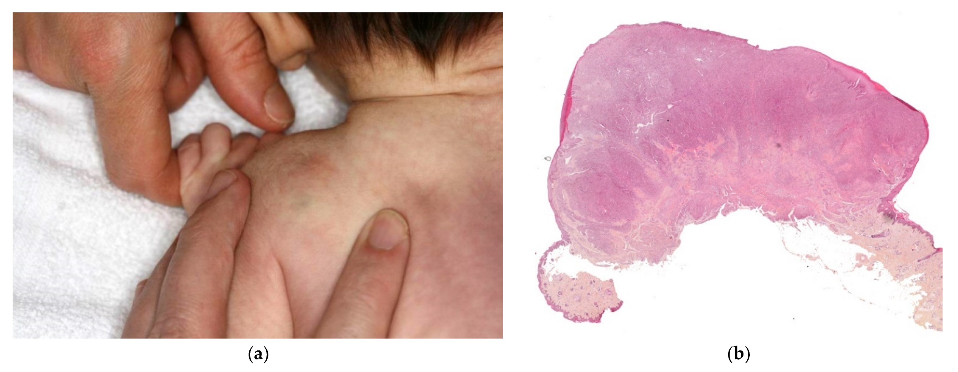 Dermatopathology 08 00043 g010a