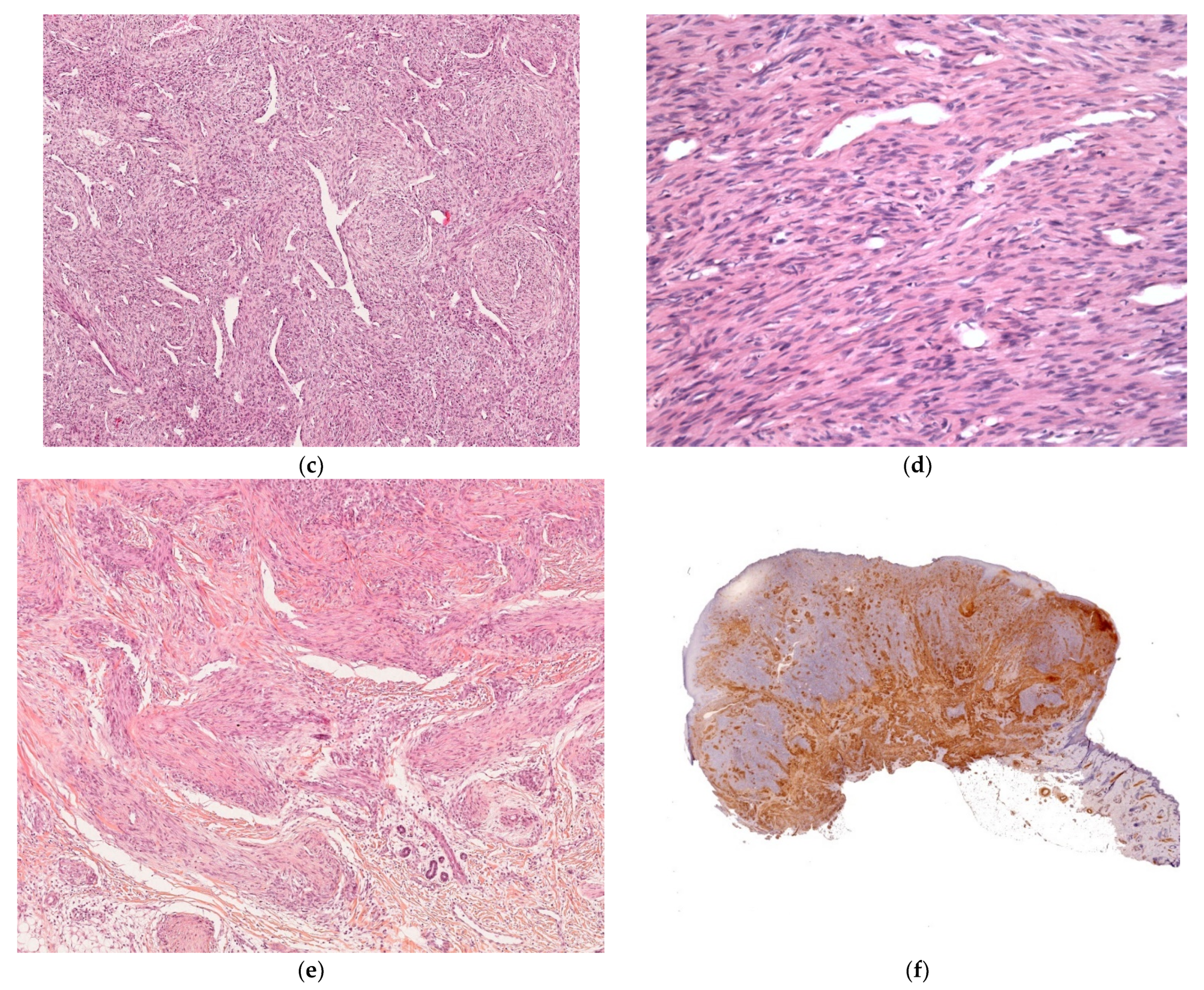 Dermatopathology 08 00043 g010b