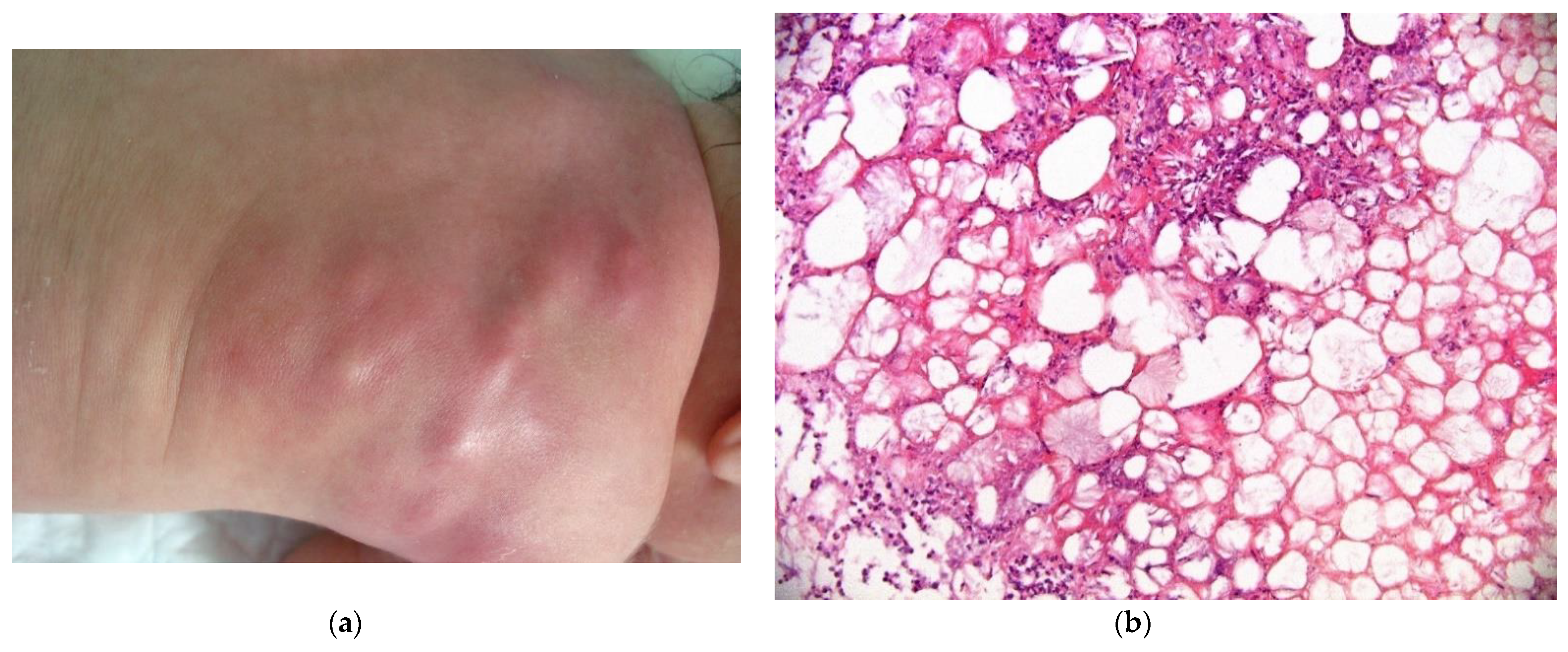 Dermatopathology 08 00043 g011