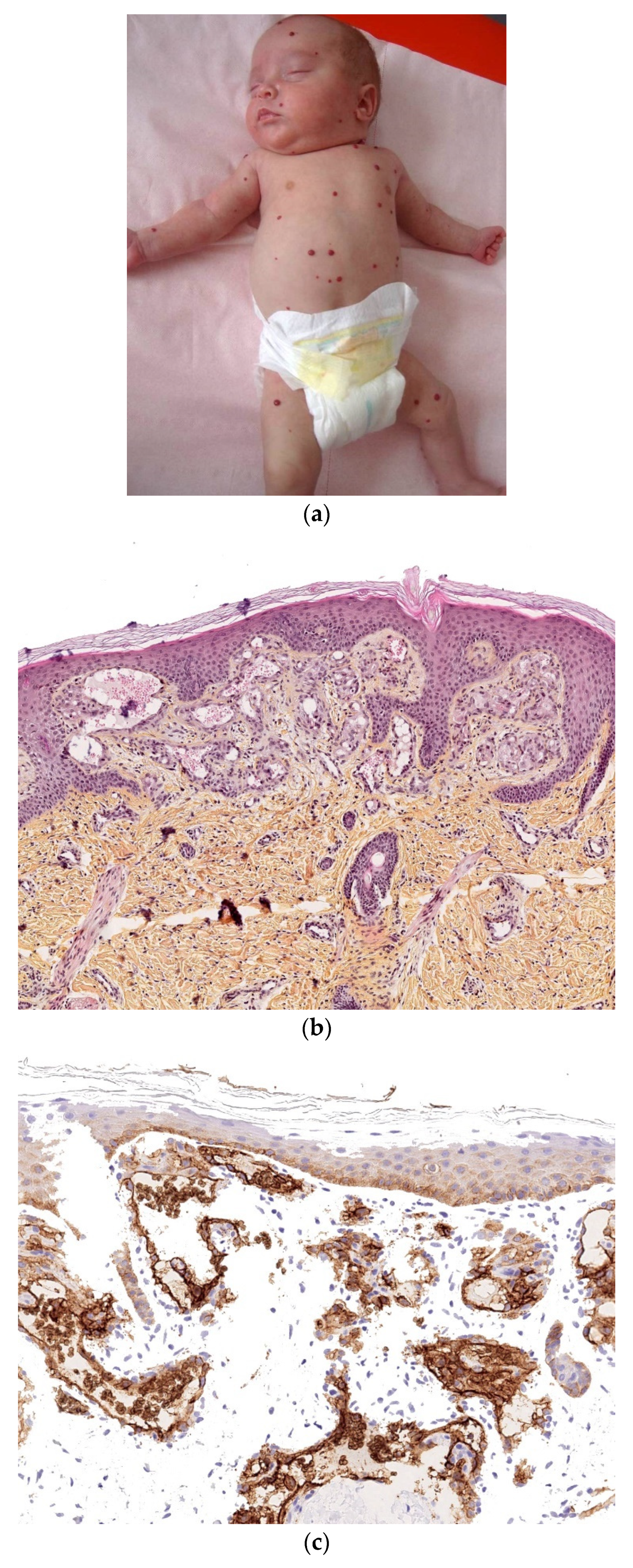 Dermatopathology 08 00043 g012
