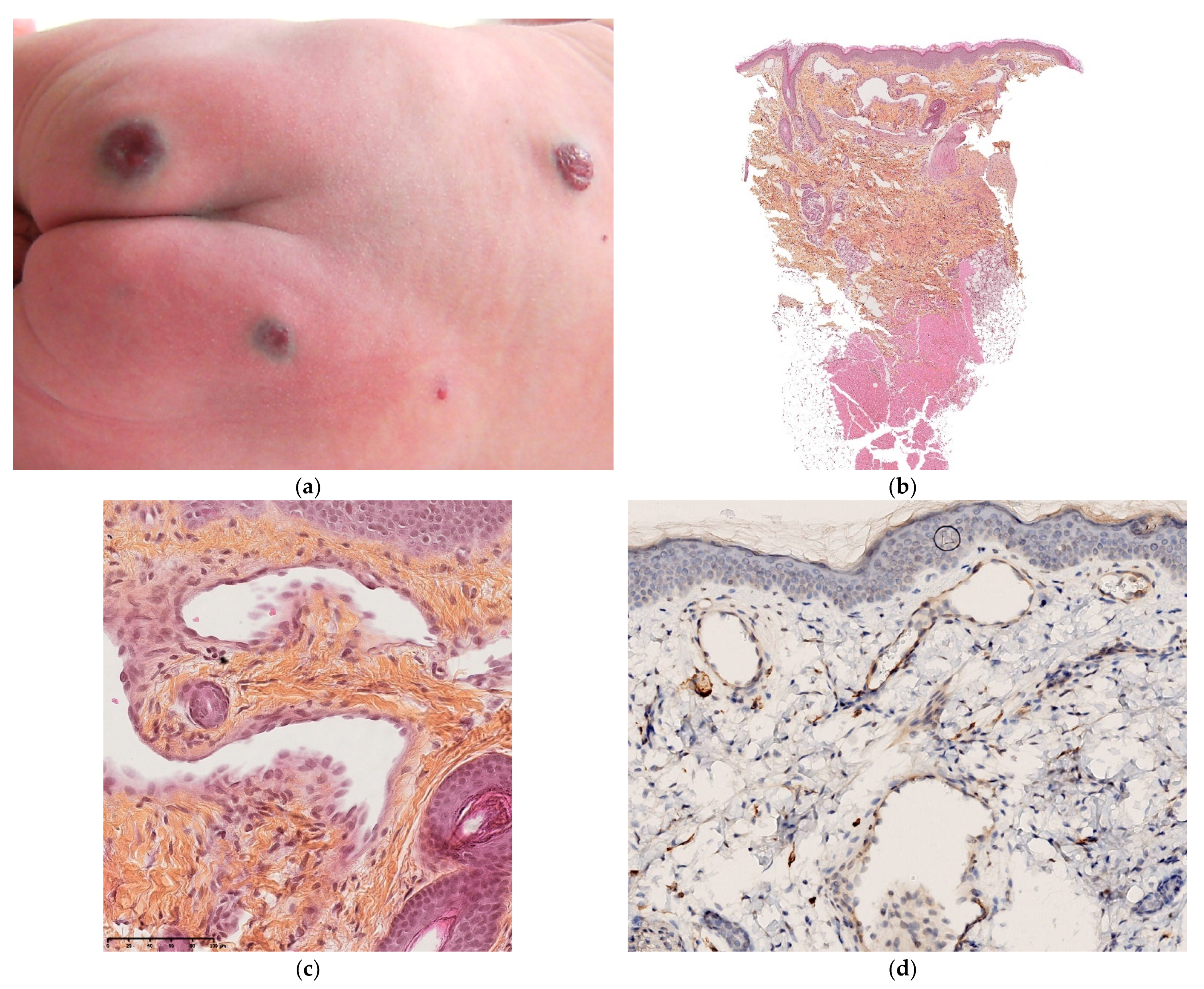 Dermatopathology 08 00043 g013