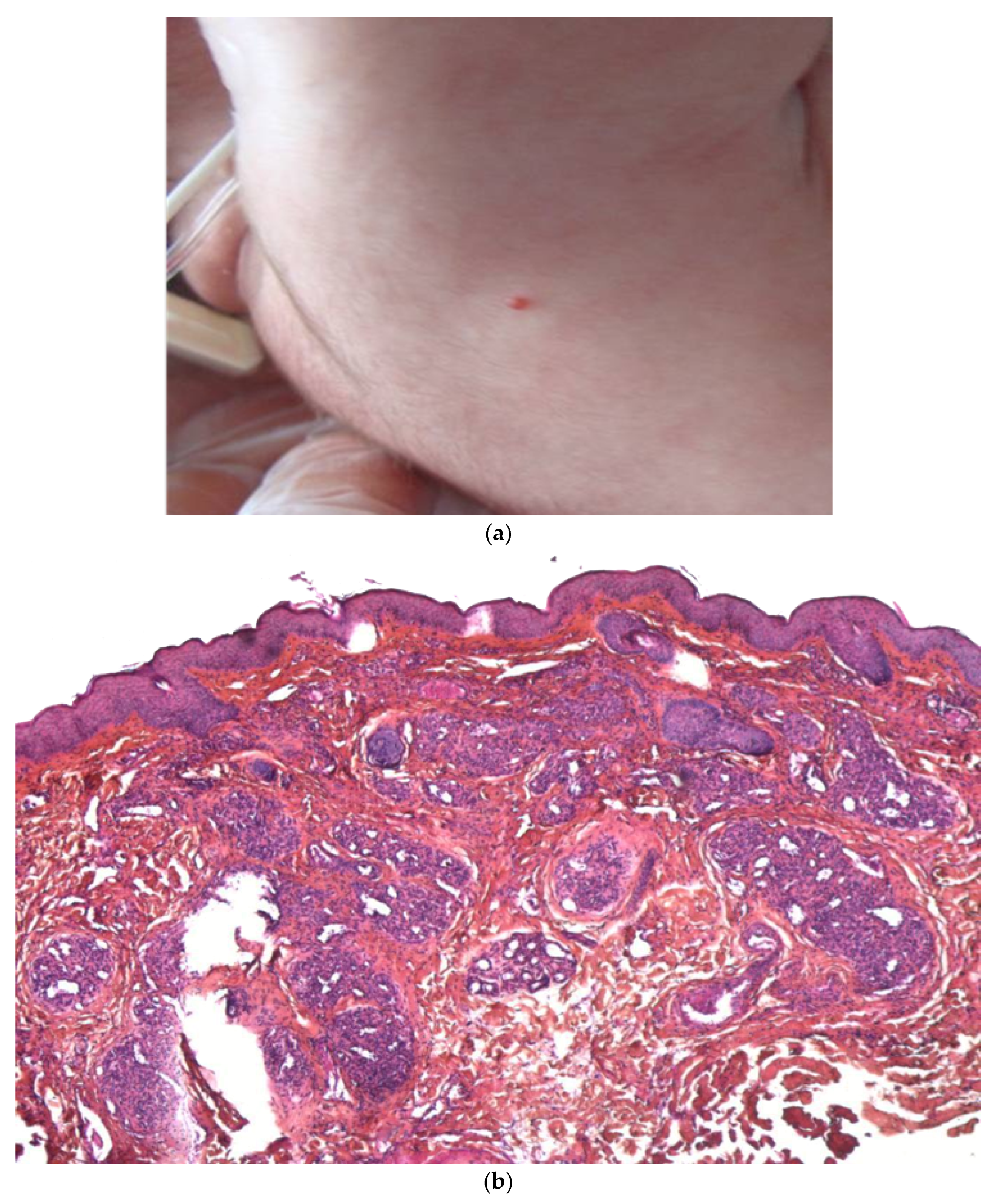 Dermatopathology 08 00043 g014a