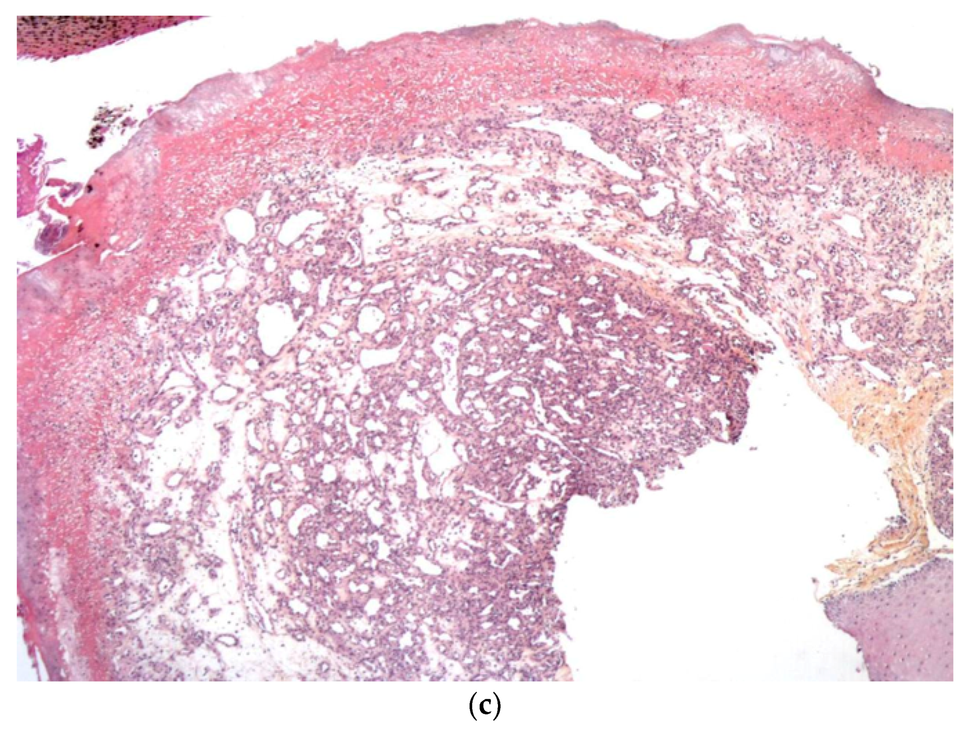 Dermatopathology 08 00043 g014b