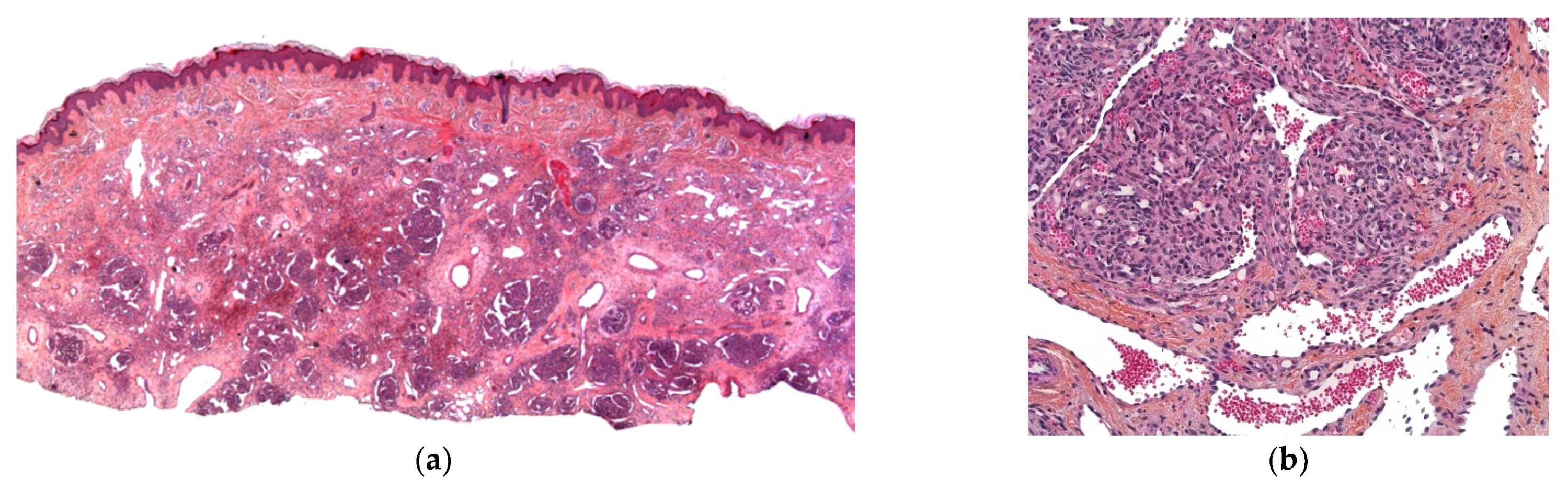 Dermatopathology 08 00043 g015a