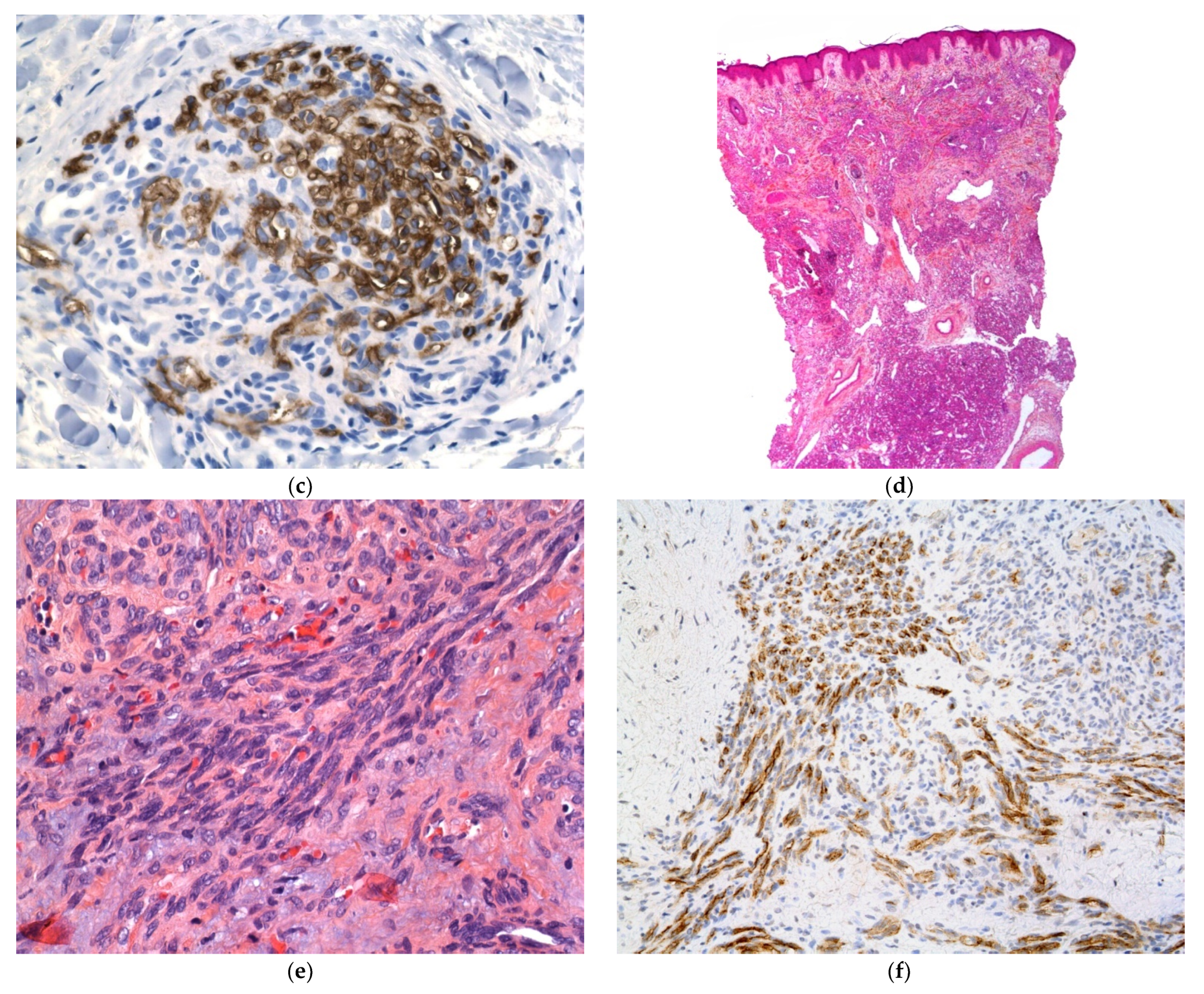 Dermatopathology 08 00043 g015b