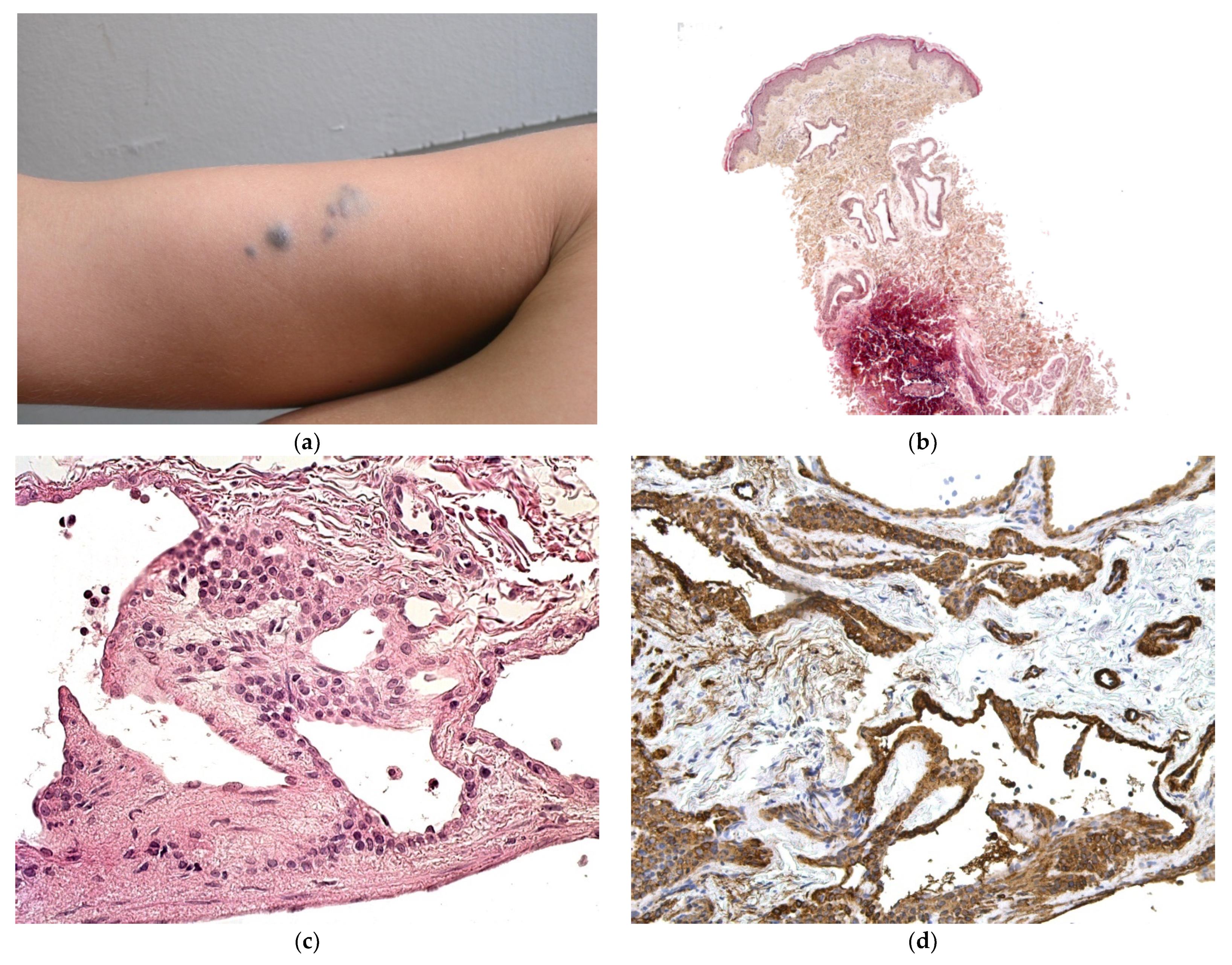 Dermatopathology 08 00043 g016